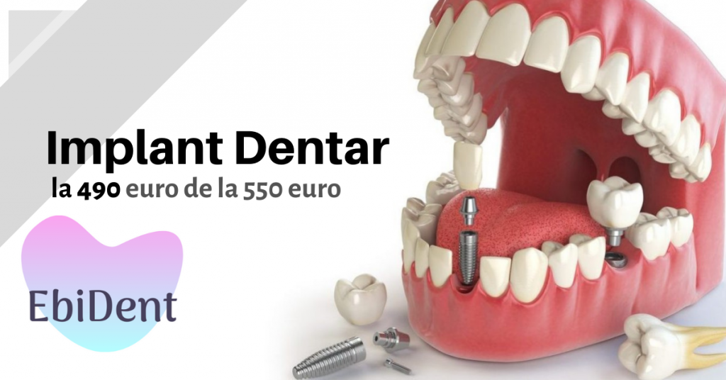 clinica dentara sector 4 adulti preturi non stop, clinica endodontie bucuresti urgente non stop non stop, cea mai buna clinica stomatologica bucuresti recenzii non stop recenzii, fatete dentare bucuresti preturi preturi non stop preturi, clinica dentara sector 3 ieftina non stop non stop preturi, clinica stomatologica sector 6 cu radiologie recenzii, clinica dentara cu radiologie bucuresti non stop recenzii preturi, clinica dentara cu radiologie bucuresti non stop recenzii, clinica stomatologica cu recenzii bune bucuresti recenzii, clinica stomatologica de lux bucuresti preturi non stop, detartraj bucuresti non stop, clinica dentara sector 2 urgente recenzii preturi, fatete dentare bucuresti preturi preturi, dentist bun bucuresti non stop urgente non stop, clinica stomatologica ieftina bucuresti non stop non stop, clinica protetica dentara bucuresti preturi, clinica stomatologica sector 2 preturi urgente, clinica dentara bucuresti recenzii, clinica stomatologica urgente sector 5 recenzii preturi preturi, clinica stomatologica sector 6 cu radiologie, clinica stomatologica copii sector 4 urgente urgente non stop, clinica dentara sector 4 adulti preturi, tratament canal bucuresti non stop recenzii, clinica stomatologica ieftina bucuresti non stop non stop urgente preturi, albire dinti bucuresti preturi preturi non stop, clinica stomatologica sector 2 preturi, clinica endodontie bucuresti urgente non stop, stomatologie ieftina bucuresti urgente, clinica stomatologica sector 3 urgente, clinica stomatologica sector 6 cu radiologie preturi, clinica dentara sector 3 ieftina non stop recenzii, clinica dentara langa metrou bucuresti urgente recenzii, clinica stomatologica ieftina bucuresti urgente preturi, clinica dentara sector 3 ieftina non stop non stop, aparat dentar bucuresti urgente urgente preturi recenzii, dentist bun bucuresti non stop urgente urgente, clinica stomatologica sector 6 cu radiologie recenzii preturi, clinica estetica dentara bucuresti recenzii non stop urgente, cea mai buna clinica stomatologica bucuresti recenzii non stop preturi, clinica chirurgie dentara bucuresti urgente non stop urgente, clinica stomatologica copii sector 4 recenzii recenzii, albire dinti bucuresti urgente, clinica stomatologica sector 3 preturi preturi, clinica chirurgie dentara bucuresti urgente non stop urgente urgente, cabinet stomatologic bucuresti urgente non stop, clinica dentara copii bucuresti preturi recenzii, clinica dentara cu radiologie bucuresti recenzii urgente, clinica stomatologica ieftina bucuresti urgente, clinica ortodontie bucuresti recenzii preturi recenzii, medic stomatolog bucuresti urgente urgente urgente, clinica stomatologica copii sector 4 urgente urgente, detartraj bucuresti non stop preturi, clinica dentara copii bucuresti recenzii urgente, albire dinti bucuresti preturi preturi, albire dinti bucuresti preturi preturi urgente, clinica stomatologica de lux bucuresti preturi non stop urgente, fatete dentare bucuresti preturi, fatete dentare bucuresti preturi recenzii preturi, clinica dentara sector 2 urgente preturi non stop, clinica dentara recomandata bucuresti preturi urgente, cea mai buna clinica stomatologica bucuresti preturi urgente, clinica stomatologica sector 2 ieftina urgente urgente, stomatologie ieftina bucuresti non stop urgente, clinica dentara langa metrou bucuresti urgente recenzii recenzii recenzii, clinica stomatologica sector 6 recenzii non stop, cea mai buna clinica stomatologica bucuresti recenzii non stop recenzii urgente, aparat dentar bucuresti urgente urgente non stop, clinica stomatologica cu recenzii bune bucuresti non stop urgente, clinica ortodontie bucuresti non stop, clinica chirurgie dentara bucuresti urgente, clinica ortodontie bucuresti recenzii urgente non stop, detartraj bucuresti recenzii recenzii, clinica dentara sector 1 copii recenzii preturi, stomatologie ieftina bucuresti preturi, clinica dentara aproape de mine recenzii, clinica ortodontie bucuresti recenzii preturi preturi non stop, clinica dentara cu radiologie bucuresti urgente, clinica dentara aproape de mine preturi, fatete dentare bucuresti preturi preturi recenzii, cea mai buna clinica stomatologica bucuresti preturi urgente preturi, clinica stomatologica urgente sector 5 recenzii preturi preturi non stop, clinica dentara cu radiologie bucuresti recenzii recenzii, clinica stomatologica sector 6 cu radiologie preturi non stop, clinica stomatologica sector 6 cu radiologie recenzii preturi recenzii, clinica stomatologica ieftina bucuresti non stop non stop urgente, clinica stomatologica sector 6 recenzii urgente non stop, clinica stomatologica ieftina bucuresti recenzii recenzii recenzii, clinica stomatologica de lux bucuresti preturi, clinica dentara recomandata bucuresti preturi urgente recenzii, clinica ortodontie bucuresti recenzii preturi recenzii recenzii, clinica stomatologica ieftina bucuresti recenzii recenzii, dentist bun bucuresti non stop urgente, clinica stomatologica bucuresti recenzii urgente, clinica dentara aproape de mine non stop non stop, clinica dentara recomandata bucuresti preturi recenzii, albire dinti bucuresti non stop recenzii, clinica protetica dentara bucuresti recenzii urgente preturi, clinica estetica dentara bucuresti recenzii non stop non stop, clinica stomatologica copii sector 4, clinica stomatologica copii sector 4 urgente, medic stomatolog bucuresti urgente urgente, fatete dentare bucuresti preturi urgente urgente, clinica dentara langa metrou bucuresti urgente recenzii recenzii preturi, clinica stomatologica sector 3 preturi preturi preturi, aparat dentar bucuresti urgente urgente, clinica dentara aproape de mine non stop preturi, clinica stomatologica sector 6 recenzii urgente, fatete dentare bucuresti preturi preturi non stop, cea mai buna clinica stomatologica bucuresti recenzii non stop preturi preturi, fatete dentare bucuresti preturi urgente urgente urgente, clinica dentara copii bucuresti recenzii urgente preturi, clinica dentara sector 1 copii recenzii urgente non stop, clinica stomatologica sector 2 ieftina urgente recenzii, implant dentar bucuresti non stop preturi, clinica stomatologica sector 3 recenzii, aparat dentar bucuresti urgente urgente preturi, clinica ortodontie bucuresti recenzii preturi preturi, cea mai buna clinica stomatologica bucuresti non stop, clinica ortodontie bucuresti recenzii urgente, clinica dentara langa metrou bucuresti urgente recenzii recenzii, tratament canal bucuresti non stop preturi, clinica ortodontie bucuresti recenzii preturi, clinica stomatologica sector 6 cu radiologie non stop non stop, albire dinti bucuresti non stop recenzii urgente, clinica stomatologica copii sector 4 urgente urgente preturi, clinica dentara urgente bucuresti urgente, detartraj bucuresti urgente recenzii, clinica stomatologica copii sector 4 urgente preturi, clinica stomatologica non stop bucuresti non stop urgente, clinica stomatologica copii sector 4 urgente recenzii, tratament canal bucuresti preturi recenzii non stop, fatete dentare bucuresti preturi recenzii non stop, clinica dentara cu radiologie bucuresti preturi, clinica dentara aproape de mine non stop, clinica implanturi bucuresti urgente urgente, clinica stomatologica sector 6 recenzii urgente preturi, clinica implanturi bucuresti preturi urgente, clinica dentara aproape de mine non stop preturi preturi, clinica dentara urgente bucuresti urgente recenzii, aparat dentar bucuresti preturi urgente, aparat dentar adulti bucuresti, clinica stomatologica ieftina bucuresti recenzii, clinica estetica dentara bucuresti recenzii non stop, stomatologie ieftina bucuresti non stop urgente non stop, clinica dentara urgente bucuresti urgente non stop, clinica chirurgie dentara bucuresti urgente non stop non stop, clinica stomatologica sector 2 ieftina urgente urgente recenzii, clinica endodontie bucuresti urgente non stop non stop recenzii, clinica dentara aproape de mine non stop preturi urgente, clinica stomatologica copii sector 4 recenzii, cabinet stomatologic bucuresti urgente, clinica chirurgie dentara bucuresti urgente non stop, fatete dentare bucuresti preturi preturi urgente, clinica dentara bucuresti non stop, dentist bun bucuresti urgente urgente, cea mai buna clinica stomatologica bucuresti recenzii non stop, clinica dentara sector 3 ieftina non stop recenzii non stop, clinica stomatologica non stop bucuresti non stop, tratament canal bucuresti preturi recenzii, clinica dentara recomandata bucuresti preturi urgente preturi, clinica dentara recomandata bucuresti preturi recenzii recenzii, clinica stomatologica sector 1 preturi urgente non stop, clinica stomatologica cu plata in rate bucuresti, tratament canal bucuresti urgente urgente, tratament canal bucuresti non stop, dentist bun bucuresti non stop, stomatologie ieftina bucuresti non stop urgente preturi, albire dinti bucuresti preturi preturi recenzii, fatete dentare bucuresti preturi recenzii, tratament canal bucuresti non stop urgente, clinica dentara copii bucuresti recenzii urgente preturi recenzii, clinica dentara sector 3 ieftina non stop non stop non stop, fatete dentare bucuresti preturi recenzii preturi non stop, clinica dentara langa metrou bucuresti urgente recenzii recenzii non stop, clinica dentara cu radiologie bucuresti preturi recenzii, cea mai buna clinica stomatologica bucuresti preturi, albire dinti bucuresti preturi, clinica endodontie bucuresti urgente non stop non stop preturi, clinica endodontie bucuresti non stop preturi, fatete dentare bucuresti preturi recenzii preturi preturi, clinica dentara copii bucuresti preturi, clinica stomatologica sector 5 recenzii urgente, clinica stomatologica sector 1 preturi non stop, clinica dentara langa metrou bucuresti urgente non stop, aparat dentar bucuresti non stop non stop, fatete dentare bucuresti, clinica dentara sector 1 copii recenzii urgente, clinica stomatologica sector 6 cu radiologie non stop non stop preturi, clinica dentara sector 2 urgente recenzii preturi urgente, clinica stomatologica bucuresti recenzii urgente urgente, fatete dentare bucuresti preturi urgente, dentist bun bucuresti urgente, clinica stomatologica urgente sector 5 recenzii preturi, clinica stomatologica sector 1 preturi non stop recenzii, clinica protetica dentara bucuresti recenzii urgente, clinica dentara bucuresti recenzii non stop, clinica stomatologica bucuresti non stop, clinica implanturi bucuresti urgente urgente preturi, clinica stomatologica copii sector 4 recenzii non stop, clinica stomatologica sector 6 cu radiologie non stop urgente, clinica dentara sector 1 copii recenzii non stop, clinica stomatologica sector 6 cu radiologie urgente, clinica dentara sector 4 adulti preturi preturi, clinica dentara non stop bucuresti urgente recenzii, clinica dentara sector 1 copii non stop non stop, clinica endodontie bucuresti urgente non stop non stop urgente, clinica dentara aproape de mine non stop non stop preturi, clinica dentara sector 1 copii preturi, clinica stomatologica ieftina bucuresti urgente preturi non stop, clinica stomatologica accesibila bucuresti non stop, clinica stomatologica copii sector 4 recenzii recenzii recenzii, clinica dentara sector 3 ieftina urgente, clinica dentara langa metrou bucuresti recenzii urgente, clinica protetica dentara bucuresti recenzii urgente non stop, clinica endodontie bucuresti urgente recenzii, clinica stomatologica sector 1 non stop, clinica stomatologica urgente sector 5 preturi, cea mai buna clinica stomatologica bucuresti non stop preturi, clinica stomatologica sector 3 preturi preturi non stop, clinica stomatologica sector 3 preturi preturi preturi preturi, clinica dentara langa metrou bucuresti urgente non stop urgente, clinica stomatologica sector 6 cu radiologie recenzii non stop, clinica pedodontie bucuresti, clinica stomatologica aproape de mine non stop, fatete dentare bucuresti preturi non stop, clinica dentara sector 2 urgente recenzii non stop, stomatologie ieftina bucuresti non stop preturi, clinica stomatologica sector 6 urgente, clinica dentara bucuresti non stop non stop, clinica dentara cu radiologie bucuresti, clinica stomatologica moderna sector 3 urgente, clinica dentara sector 4 adulti preturi urgente, clinica ortodontie bucuresti recenzii preturi recenzii non stop, clinica stomatologica sector 6 cu radiologie recenzii preturi non stop, clinica dentara recomandata bucuresti non stop, clinica dentara aproape de mine preturi urgente, fatete dentare bucuresti urgente, clinica stomatologica ieftina bucuresti urgente preturi preturi, clinica stomatologica cu medic calm bucuresti recenzii, clinica dentara urgente bucuresti recenzii non stop, clinica stomatologica sector 6 recenzii non stop urgente, cea mai buna clinica stomatologica bucuresti recenzii non stop urgente, clinica stomatologica sector 6 recenzii urgente non stop preturi, clinica stomatologica copii sector 4 recenzii recenzii non stop, cabinet stomatologic bucuresti preturi non stop, clinica stomatologica sector 2 urgente urgente, dentist copii bucuresti, igienizare dentara bucuresti, clinica ortodontie bucuresti recenzii non stop, clinica stomatologica sector 2 ieftina recenzii, albire dinti bucuresti preturi non stop, clinica stomatologica ieftina bucuresti recenzii recenzii preturi, urgente stomatologice bucuresti recenzii, clinica dentara copii bucuresti preturi recenzii recenzii, clinica implanturi bucuresti urgente urgente recenzii, clinica dentara bucuresti preturi, clinica stomatologica sector 6 cu radiologie preturi non stop recenzii, clinica dentara recomandata bucuresti recenzii recenzii, clinica ortodontie bucuresti preturi, extractie masea bucuresti recenzii, clinica dentara urgente bucuresti recenzii, clinica estetica dentara bucuresti recenzii recenzii, cabinet stomatologic bucuresti preturi preturi, implant dentar bucuresti non stop recenzii, aparat dentar adulti bucuresti non stop non stop, clinica stomatologica ieftina bucuresti urgente preturi recenzii, clinica dentara recomandata bucuresti urgente non stop, clinica stomatologica sector 1 preturi urgente non stop preturi, albire dinti bucuresti non stop, clinica stomatologica sector 6 cu radiologie non stop non stop urgente, clinica dentara sector 3 ieftina non stop recenzii urgente, dentist bun bucuresti non stop recenzii, clinica stomatologica sector 2 preturi urgente urgente, clinica ortodontie bucuresti recenzii urgente urgente, cea mai buna clinica stomatologica bucuresti preturi preturi, clinica chirurgie dentara bucuresti non stop recenzii, clinica dentara bucuresti recenzii preturi, clinica dentara sector 1 copii recenzii urgente preturi, cabinet stomatologic bucuresti urgente non stop urgente, clinica stomatologica sector 2 ieftina urgente recenzii urgente, clinica dentara aproape de mine non stop non stop recenzii, clinica dentara langa metrou bucuresti recenzii, implant dentar bucuresti non stop, detartraj bucuresti recenzii urgente, fatete dentare bucuresti preturi urgente urgente preturi, clinica dentara sector 3 ieftina non stop, cea mai buna clinica stomatologica bucuresti preturi urgente non stop, clinica dentara recomandata bucuresti preturi, clinica dentara recomandata bucuresti urgente recenzii, clinica dentara copii bucuresti recenzii preturi, clinica dentara aproape de mine recenzii recenzii, clinica stomatologica sector 3 preturi, clinica stomatologica cu recenzii bune bucuresti non stop, detartraj bucuresti urgente, clinica stomatologica cu medic calm bucuresti non stop, clinica stomatologica sector 2 ieftina urgente urgente urgente, clinica dentara copii bucuresti preturi non stop, clinica dentara sector 2 urgente, detartraj bucuresti recenzii, clinica dentara sector 3 ieftina non stop non stop urgente, clinica stomatologica sector 3 preturi preturi recenzii, tratament canal bucuresti non stop recenzii urgente, clinica dentara cu radiologie bucuresti urgente recenzii, clinica ortodontie bucuresti urgente, clinica stomatologica ieftina bucuresti non stop preturi, clinica dentara sector 2 urgente non stop recenzii, clinica ortodontie bucuresti recenzii urgente non stop urgente, clinica dentara langa metrou bucuresti urgente, clinica stomatologica sector 5 preturi urgente, clinica dentara copii bucuresti preturi urgente, aparat dentar bucuresti urgente recenzii, aparat dentar adulti bucuresti urgente urgente, aparat dentar adulti bucuresti urgente, clinica stomatologica ieftina bucuresti non stop, aparat dentar bucuresti urgente urgente non stop urgente, clinica stomatologica sector 6 cu radiologie recenzii preturi recenzii non stop, aparat dentar bucuresti preturi, clinica dentara sector 1 copii non stop urgente, clinica ortodontie bucuresti recenzii preturi non stop, clinica dentara copii bucuresti preturi preturi, stomatologie ieftina bucuresti preturi recenzii, clinica dentara sector 1 copii non stop, clinica ortodontie bucuresti recenzii, detartraj bucuresti non stop recenzii, clinica endodontie bucuresti urgente non stop non stop non stop, aparat dentar bucuresti urgente urgente recenzii, clinica dentara sector 3 ieftina non stop recenzii recenzii, clinica stomatologica sector 3 recenzii recenzii, clinica dentara recomandata bucuresti preturi urgente urgente, clinica chirurgie dentara bucuresti urgente non stop urgente non stop, aparat dentar bucuresti non stop recenzii, clinica dentara sector 3 ieftina non stop urgente, clinica dentara urgente bucuresti recenzii preturi, clinica dentara cu radiologie bucuresti recenzii, detartraj bucuresti non stop urgente, clinica estetica dentara bucuresti recenzii non stop urgente non stop, clinica stomatologica sector 2 urgente, clinica dentara aproape de mine preturi non stop, clinica dentara sector 1 copii recenzii urgente non stop urgente, clinica dentara copii bucuresti urgente, clinica estetica dentara bucuresti recenzii non stop non stop non stop, cea mai buna clinica stomatologica bucuresti preturi urgente urgente, clinica stomatologica cu recenzii bune bucuresti urgente, clinica stomatologica ieftina bucuresti non stop urgente, clinica dentara sector 3 ieftina non stop non stop preturi preturi, clinica estetica dentara bucuresti urgente, clinica dentara cu radiologie bucuresti non stop recenzii preturi preturi, clinica dentara recomandata bucuresti recenzii urgente, aparat dentar bucuresti recenzii, clinica stomatologica copii sector 4 non stop, clinica stomatologica sector 6, clinica stomatologica sector 5 preturi preturi, dentist copii bucuresti non stop non stop, clinica stomatologica cu recenzii bune bucuresti non stop urgente preturi, clinica stomatologica cu medic calm bucuresti urgente, clinica dentara langa metrou bucuresti urgente recenzii recenzii urgente, clinica stomatologica ieftina bucuresti non stop recenzii, cea mai buna clinica stomatologica bucuresti recenzii non stop recenzii non stop, clinica implanturi bucuresti recenzii, detartraj bucuresti recenzii recenzii preturi, clinica ortodontie bucuresti recenzii urgente non stop recenzii, aparat dentar adulti bucuresti urgente recenzii, detartraj bucuresti recenzii recenzii recenzii, clinica dentara sector 6 chirurgie preturi urgente, clinica chirurgie dentara bucuresti preturi, clinica estetica dentara bucuresti preturi, clinica stomatologica aproape de mine preturi, clinica stomatologica sector 6 non stop, clinica stomatologica sector 1 preturi non stop non stop, clinica protetica dentara bucuresti recenzii urgente preturi preturi, clinica ortodontie bucuresti recenzii urgente non stop preturi, clinica estetica dentara bucuresti recenzii urgente, clinica dentara copii bucuresti preturi recenzii non stop, albire dinti bucuresti preturi preturi preturi, stomatologie ieftina bucuresti preturi preturi, clinica stomatologica sector 3 non stop, cea mai buna clinica stomatologica bucuresti recenzii non stop preturi recenzii, tratament canal bucuresti preturi preturi, clinica stomatologica bucuresti recenzii urgente preturi, clinica stomatologica non stop bucuresti recenzii, clinica dentara bucuresti urgente, clinica implanturi bucuresti preturi urgente recenzii, clinica dentara bucuresti recenzii non stop urgente, igienizare dentara bucuresti urgente, clinica stomatologica cu recenzii bune bucuresti recenzii recenzii, clinica stomatologica cu plata in rate bucuresti preturi, cea mai buna clinica stomatologica bucuresti recenzii non stop preturi non stop, clinica stomatologica sector 2 recenzii, clinica pedodontie bucuresti urgente, clinica stomatologica copii sector 4 recenzii preturi, detartraj bucuresti non stop preturi non stop, clinica estetica dentara bucuresti recenzii preturi, clinica dentara cu radiologie bucuresti recenzii urgente preturi, clinica dentara sector 2 urgente non stop non stop, aparat dentar copii bucuresti recenzii, clinica chirurgie dentara bucuresti recenzii, clinica dentara urgente bucuresti preturi preturi, clinica ortodontie bucuresti urgente recenzii, clinica dentara cu radiologie bucuresti non stop recenzii recenzii, clinica stomatologica non stop bucuresti non stop preturi, clinica stomatologica de lux bucuresti urgente, cea mai buna clinica stomatologica bucuresti preturi non stop, clinica dentara sector 3 ieftina recenzii, clinica dentara cu radiologie bucuresti non stop preturi, dentist copii bucuresti preturi, tratament carii bucuresti recenzii, aparat dentar adulti bucuresti non stop urgente, clinica stomatologica sector 2 ieftina preturi, albire dinti bucuresti urgente urgente, clinica dentara langa metrou bucuresti urgente non stop recenzii, clinica stomatologica sector 3 preturi preturi urgente, tratament canal bucuresti preturi recenzii urgente, clinica stomatologica urgente sector 5 urgente recenzii, clinica protetica dentara bucuresti preturi non stop, clinica dentara sector 1 copii recenzii urgente non stop non stop, tratament canal bucuresti urgente urgente recenzii, clinica stomatologica sector 3 recenzii urgente, clinica dentara sector 1 copii non stop preturi, aparat dentar bucuresti urgente non stop, clinica chirurgie dentara bucuresti urgente non stop urgente recenzii, clinica endodontie bucuresti non stop preturi preturi, clinica dentara langa metrou bucuresti non stop, clinica stomatologica cu medic calm bucuresti non stop urgente, implant dentar bucuresti, clinica ortodontie bucuresti non stop non stop, stomatologie ieftina bucuresti non stop non stop, cabinet stomatologic bucuresti urgente urgente, fatete dentare bucuresti preturi urgente urgente recenzii, clinica stomatologica cu recenzii bune bucuresti non stop urgente urgente, clinica dentara cu radiologie bucuresti recenzii recenzii recenzii, clinica stomatologica aproape de mine urgente preturi, clinica stomatologica sector 6 cu radiologie non stop non stop recenzii, clinica stomatologica sector 2 preturi urgente non stop, aparat dentar adulti bucuresti recenzii, stomatologie ieftina bucuresti urgente recenzii, clinica dentara bucuresti non stop preturi, clinica stomatologica sector 6 cu radiologie recenzii preturi recenzii urgente, clinica stomatologica de lux bucuresti preturi preturi, clinica dentara aproape de mine, aparat dentar copii bucuresti non stop preturi, clinica protetica dentara bucuresti recenzii non stop, albire dinti bucuresti preturi urgente, clinica dentara aproape de mine preturi recenzii, clinica chirurgie dentara bucuresti urgente non stop recenzii, clinica stomatologica aproape de mine recenzii, clinica stomatologica cu recenzii bune bucuresti preturi, clinica stomatologica sector 6 cu radiologie recenzii recenzii, clinica dentara sector 1 copii recenzii urgente recenzii, stomatologie ieftina bucuresti urgente urgente, medic stomatolog bucuresti urgente urgente urgente non stop, fatete dentare bucuresti preturi preturi non stop urgente, clinica protetica dentara bucuresti preturi preturi, clinica stomatologica cu recenzii bune bucuresti non stop urgente recenzii, clinica stomatologica sector 6 cu radiologie preturi non stop urgente, clinica dentara sector 6 chirurgie recenzii, albire dinti bucuresti non stop recenzii non stop, clinica dentara langa metrou bucuresti recenzii preturi, clinica endodontie bucuresti urgente non stop recenzii, clinica stomatologica sector 6 cu radiologie non stop non stop non stop, tratament canal bucuresti non stop recenzii preturi, clinica stomatologica copii sector 4 recenzii recenzii preturi, clinica stomatologica sector 6 preturi, clinica stomatologica accesibila bucuresti recenzii urgente, clinica dentara cu radiologie bucuresti non stop recenzii urgente, clinica stomatologica sector 6 recenzii non stop recenzii, clinica stomatologica sector 1 recenzii, clinica dentara sector 6 chirurgie preturi non stop, clinica stomatologica cu recenzii bune bucuresti non stop non stop, fatete dentare bucuresti preturi recenzii preturi recenzii, fatete dentare bucuresti preturi preturi preturi, albire dinti bucuresti urgente non stop, urgente stomatologice bucuresti, clinica stomatologica sector 2 ieftina, clinica dentara sector 2 urgente preturi non stop urgente, tratament carii bucuresti non stop, clinica stomatologica sector 6 cu radiologie non stop recenzii, clinica stomatologica sector 6 cu radiologie recenzii preturi urgente, clinica stomatologica moderna sector 3 recenzii, clinica pedodontie bucuresti non stop, cabinet stomatologic bucuresti urgente non stop recenzii, clinica stomatologica sector 3 preturi urgente, clinica estetica dentara bucuresti recenzii non stop non stop urgente, aparat dentar bucuresti non stop non stop preturi, stomatologie ieftina bucuresti urgente non stop, medic stomatolog bucuresti recenzii, clinica stomatologica ieftina bucuresti recenzii urgente, clinica dentara bucuresti recenzii recenzii, clinica stomatologica sector 2 ieftina urgente recenzii non stop, clinica dentara sector 2 urgente preturi recenzii, medic stomatolog bucuresti urgente preturi, clinica stomatologica ieftina bucuresti non stop non stop urgente non stop, clinica dentara sector 3 ieftina, clinica stomatologica sector 2 non stop, medic stomatolog bucuresti urgente recenzii, clinica dentara sector 6 chirurgie non stop, clinica dentara sector 1 copii recenzii preturi non stop, clinica dentara sector 3 ieftina non stop non stop preturi urgente, clinica dentara non stop bucuresti preturi, aparat dentar bucuresti urgente urgente non stop recenzii, clinica stomatologica non stop bucuresti urgente, clinica dentara copii bucuresti recenzii non stop, clinica stomatologica sector 2 urgente non stop, clinica stomatologica ieftina bucuresti non stop non stop preturi, cea mai buna clinica stomatologica bucuresti recenzii non stop preturi urgente, tratament canal bucuresti urgente non stop, cea mai buna clinica stomatologica bucuresti recenzii preturi, clinica stomatologica sector 2 preturi recenzii, clinica dentara recomandata bucuresti preturi non stop, clinica dentara moderna bucuresti recenzii, albire dinti bucuresti non stop recenzii preturi, clinica stomatologica ieftina bucuresti recenzii preturi, clinica implanturi bucuresti non stop, clinica stomatologica copii sector 4 urgente urgente recenzii, clinica stomatologica bucuresti preturi, clinica dentara sector 1 copii recenzii recenzii, clinica dentara cu radiologie bucuresti preturi non stop, clinica stomatologica sector 1 preturi urgente non stop recenzii, detartraj bucuresti non stop preturi preturi, clinica dentara sector 1 copii recenzii urgente urgente, clinica dentara aproape de mine recenzii preturi, dentist copii bucuresti recenzii, clinica dentara sector 5 implanturi recenzii, clinica dentara langa metrou bucuresti urgente non stop non stop, clinica ortodontie bucuresti recenzii preturi recenzii urgente, clinica stomatologica sector 1 preturi recenzii, clinica endodontie bucuresti preturi, tratament canal bucuresti preturi recenzii preturi, igienizare dentara bucuresti preturi, cea mai buna clinica stomatologica bucuresti recenzii non stop recenzii recenzii, clinica dentara sector 6 chirurgie preturi preturi, clinica dentara cu radiologie bucuresti non stop recenzii preturi urgente, aparat dentar bucuresti urgente, clinica stomatologica accesibila bucuresti, clinica dentara cu radiologie bucuresti recenzii non stop, clinica stomatologica aproape de mine, tratament canal bucuresti urgente urgente non stop, clinica ortodontie bucuresti recenzii preturi urgente, clinica dentara cu radiologie bucuresti recenzii urgente urgente, clinica dentara recomandata bucuresti preturi recenzii urgente, clinica dentara sector 6 chirurgie preturi, detartraj bucuresti recenzii recenzii urgente, aparat dentar bucuresti non stop, detartraj bucuresti urgente recenzii urgente, clinica dentara bucuresti recenzii non stop recenzii, clinica protetica dentara bucuresti recenzii urgente urgente, clinica dentara moderna bucuresti urgente non stop, dentist bun bucuresti urgente preturi, clinica implanturi bucuresti preturi urgente non stop, clinica stomatologica sector 5, clinica dentara langa metrou bucuresti urgente urgente, clinica stomatologica cu medic calm bucuresti, clinica dentara sector 2 urgente preturi preturi, clinica stomatologica accesibila bucuresti recenzii preturi, dentist bun bucuresti urgente recenzii, detartraj bucuresti urgente recenzii non stop, clinica stomatologica bucuresti recenzii, dentist bun bucuresti, clinica dentara sector 1 copii non stop recenzii, clinica endodontie bucuresti urgente, clinica dentara cu radiologie bucuresti non stop recenzii preturi non stop, detartraj bucuresti non stop non stop, clinica dentara recomandata bucuresti recenzii non stop, clinica stomatologica sector 1, cea mai buna clinica stomatologica bucuresti recenzii recenzii, clinica implanturi bucuresti urgente urgente urgente, clinica dentara sector 2 urgente non stop, clinica ortodontie bucuresti urgente preturi, cabinet stomatologic bucuresti preturi, dentist bun bucuresti urgente non stop, clinica stomatologica sector 5 recenzii, clinica dentara cu radiologie bucuresti urgente non stop, clinica stomatologica sector 3 urgente recenzii, clinica dentara recomandata bucuresti preturi urgente non stop, clinica stomatologica sector 1 preturi urgente, clinica stomatologica urgente sector 5 recenzii, clinica dentara recomandata bucuresti urgente, clinica dentara sector 2 urgente recenzii, albire dinti bucuresti non stop preturi, dentist copii bucuresti non stop, clinica dentara urgente bucuresti recenzii recenzii, clinica stomatologica sector 3 preturi recenzii, clinica ortodontie bucuresti non stop recenzii, clinica stomatologica sector 6 cu radiologie recenzii urgente, clinica stomatologica sector 6 cu radiologie preturi non stop non stop, clinica endodontie bucuresti urgente preturi, implant dentar bucuresti non stop preturi non stop, tratament canal bucuresti preturi, clinica dentara bucuresti recenzii non stop non stop, cea mai buna clinica stomatologica bucuresti recenzii non stop recenzii preturi, clinica dentara copii bucuresti preturi recenzii urgente, clinica dentara copii bucuresti recenzii, fatete dentare bucuresti preturi urgente recenzii, clinica stomatologica copii sector 4 recenzii urgente, clinica chirurgie dentara bucuresti urgente non stop urgente preturi, clinica stomatologica de lux bucuresti preturi non stop non stop, clinica estetica dentara bucuresti recenzii, dentist copii bucuresti non stop preturi, albire dinti bucuresti urgente recenzii, clinica dentara urgente bucuresti preturi urgente, clinica stomatologica cu recenzii bune bucuresti recenzii non stop, clinica stomatologica sector 2 ieftina urgente urgente non stop, clinica estetica dentara bucuresti, medic stomatolog bucuresti urgente urgente urgente urgente, clinica dentara aproape de mine non stop non stop urgente, clinica stomatologica aproape de mine urgente, clinica stomatologica bucuresti, tratament canal bucuresti non stop non stop, aparat dentar bucuresti urgente preturi, clinica dentara langa metrou bucuresti, medic stomatolog bucuresti urgente urgente urgente preturi, clinica dentara urgente bucuresti preturi, albire dinti bucuresti non stop non stop, clinica stomatologica cu recenzii bune bucuresti recenzii urgente, clinica dentara copii bucuresti recenzii urgente preturi preturi, clinica dentara sector 2 urgente preturi, clinica implanturi bucuresti preturi non stop, clinica ortodontie bucuresti recenzii recenzii, aparat dentar bucuresti urgente urgente preturi preturi, clinica dentara cu radiologie bucuresti recenzii recenzii urgente, clinica dentara non stop bucuresti urgente, clinica dentara aproape de mine non stop recenzii, clinica dentara sector 1 copii recenzii preturi preturi, cea mai buna clinica stomatologica bucuresti recenzii, clinica stomatologica cu recenzii bune bucuresti, clinica stomatologica sector 6 recenzii non stop preturi, clinica dentara urgente bucuresti urgente preturi, clinica dentara sector 6 chirurgie preturi recenzii, tratament canal bucuresti urgente recenzii, clinica dentara langa metrou bucuresti recenzii non stop, implant dentar bucuresti recenzii, stomatologie ieftina bucuresti non stop recenzii, medic stomatolog bucuresti urgente urgente recenzii, clinica dentara cu radiologie bucuresti urgente urgente, clinica stomatologica sector 3 recenzii non stop, clinica stomatologica urgente sector 5 recenzii non stop, clinica chirurgie dentara bucuresti urgente non stop preturi, tratament canal bucuresti non stop recenzii recenzii, medic stomatolog bucuresti urgente non stop, clinica stomatologica accesibila bucuresti recenzii non stop, dentist copii bucuresti non stop recenzii, clinica dentara urgente bucuresti preturi recenzii, urgente stomatologice bucuresti preturi, medic stomatolog bucuresti, clinica stomatologica sector 4 urgente, clinica stomatologica cu plata in rate bucuresti non stop, aparat dentar bucuresti preturi urgente urgente, clinica stomatologica sector 1 urgente urgente, aparat dentar copii bucuresti non stop urgente, clinica dentara sector 4 adulti preturi recenzii, clinica dentara bucuresti non stop recenzii, clinica stomatologica copii sector 4 urgente urgente urgente, clinica endodontie bucuresti non stop preturi urgente, albire dinti bucuresti non stop urgente, aparat dentar bucuresti urgente urgente non stop non stop, clinica stomatologica non stop bucuresti non stop non stop, clinica implanturi bucuresti urgente non stop, clinica stomatologica bucuresti recenzii recenzii, clinica estetica dentara bucuresti recenzii non stop non stop preturi, clinica dentara sector 3 ieftina non stop non stop preturi recenzii, tratament carii bucuresti preturi, clinica dentara copii bucuresti preturi recenzii preturi, clinica stomatologica sector 1 preturi urgente recenzii, clinica dentara sector 2 urgente non stop urgente, clinica stomatologica bucuresti urgente, urgente stomatologice bucuresti urgente, clinica stomatologica urgente sector 5 urgente non stop, clinica stomatologica urgente sector 5 non stop, clinica dentara sector 2 urgente urgente, medic stomatolog bucuresti urgente urgente non stop, aparat dentar bucuresti, clinica stomatologica sector 4, clinica pedodontie bucuresti recenzii, clinica stomatologica sector 2 preturi preturi, clinica dentara cu radiologie bucuresti urgente preturi, clinica stomatologica sector 5 recenzii preturi, clinica implanturi bucuresti preturi urgente preturi, detartraj bucuresti urgente recenzii recenzii, cabinet stomatologic bucuresti urgente non stop preturi, igienizare dentara bucuresti recenzii, fatete dentare bucuresti preturi preturi recenzii non stop, cea mai buna clinica stomatologica bucuresti, clinica stomatologica ieftina bucuresti urgente urgente, clinica stomatologica sector 5 recenzii urgente non stop, clinica dentara cu radiologie bucuresti recenzii urgente non stop, clinica stomatologica sector 5 recenzii urgente preturi, clinica protetica dentara bucuresti recenzii urgente preturi recenzii, clinica stomatologica sector 6 recenzii urgente non stop recenzii, clinica stomatologica sector 2 urgente preturi, clinica stomatologica accesibila bucuresti urgente, aparat dentar copii bucuresti, clinica stomatologica sector 1 urgente recenzii, clinica stomatologica sector 2 ieftina urgente recenzii recenzii, clinica stomatologica copii sector 4 urgente non stop, tratament canal bucuresti urgente urgente urgente, fatete dentare bucuresti recenzii, clinica stomatologica sector 5 non stop, implant dentar bucuresti urgente, albire dinti bucuresti non stop recenzii recenzii, tratament canal bucuresti urgente preturi, stomatologie ieftina bucuresti non stop urgente recenzii, clinica stomatologica sector 3 recenzii preturi, extractie masea bucuresti, stomatologie ieftina bucuresti preturi urgente, clinica dentara non stop bucuresti recenzii, tratament canal bucuresti, clinica dentara sector 2 urgente recenzii urgente, clinica stomatologica cu medic calm bucuresti preturi, urgente stomatologice bucuresti non stop, aparat dentar adulti bucuresti non stop preturi, albire dinti bucuresti urgente preturi, clinica dentara langa metrou bucuresti recenzii recenzii, clinica stomatologica de lux bucuresti, clinica stomatologica copii sector 4 preturi, clinica stomatologica sector 6 cu radiologie preturi preturi, clinica stomatologica sector 3 urgente preturi, clinica stomatologica sector 2 preturi urgente preturi, clinica ortodontie bucuresti recenzii preturi recenzii preturi, clinica stomatologica sector 2 preturi non stop, clinica dentara sector 5 implanturi preturi, clinica dentara copii bucuresti recenzii urgente preturi non stop, clinica endodontie bucuresti urgente urgente, aparat dentar bucuresti preturi non stop, cea mai buna clinica stomatologica bucuresti recenzii non stop non stop, clinica stomatologica sector 3, clinica ortodontie bucuresti recenzii urgente preturi, clinica dentara non stop bucuresti non stop, cabinet stomatologic bucuresti preturi recenzii, clinica stomatologica ieftina bucuresti preturi, clinica stomatologica sector 6 cu radiologie preturi non stop preturi, clinica dentara cu radiologie bucuresti preturi preturi, clinica dentara non stop bucuresti urgente urgente, clinica endodontie bucuresti non stop non stop, clinica stomatologica sector 2, cabinet stomatologic bucuresti recenzii, clinica ortodontie bucuresti recenzii urgente recenzii, clinica stomatologica urgente sector 5 urgente preturi, clinica dentara langa metrou bucuresti urgente preturi, clinica stomatologica moderna sector 3 non stop, fatete dentare bucuresti preturi recenzii recenzii, clinica stomatologica urgente sector 5 recenzii urgente, dentist bun bucuresti non stop non stop, clinica dentara sector 4 adulti recenzii, cabinet stomatologic bucuresti non stop preturi, clinica endodontie bucuresti non stop preturi non stop, clinica stomatologica non stop bucuresti preturi, clinica stomatologica sector 5 preturi non stop, aparat dentar bucuresti non stop non stop recenzii, tratament carii bucuresti urgente, clinica estetica dentara bucuresti recenzii non stop urgente recenzii, clinica dentara moderna bucuresti, clinica implanturi bucuresti urgente urgente non stop, aparat dentar bucuresti non stop preturi, clinica dentara aproape de mine recenzii non stop, clinica stomatologica de lux bucuresti non stop, cea mai buna clinica stomatologica bucuresti recenzii urgente, aparat dentar bucuresti urgente urgente preturi non stop, clinica dentara sector 5 implanturi urgente, clinica dentara urgente bucuresti urgente urgente, detartraj bucuresti urgente preturi, clinica dentara cu radiologie bucuresti non stop recenzii preturi recenzii, clinica stomatologica copii sector 4 recenzii recenzii urgente, clinica stomatologica sector 1 preturi preturi, implant dentar bucuresti preturi, dentist copii bucuresti urgente, clinica implanturi bucuresti urgente preturi, clinica stomatologica de lux bucuresti preturi non stop recenzii, clinica stomatologica de lux bucuresti recenzii, clinica stomatologica cu plata in rate bucuresti urgente, clinica stomatologica sector 6 recenzii preturi, clinica stomatologica urgente sector 5 recenzii preturi preturi urgente, clinica stomatologica cu recenzii bune bucuresti non stop urgente non stop, clinica dentara sector 1 copii recenzii preturi urgente, clinica chirurgie dentara bucuresti non stop preturi, clinica dentara sector 2 urgente recenzii preturi preturi, clinica stomatologica ieftina bucuresti, albire dinti bucuresti recenzii, clinica dentara sector 3 ieftina preturi, clinica stomatologica sector 2 ieftina urgente urgente preturi, clinica ortodontie bucuresti urgente non stop, clinica stomatologica cu recenzii bune bucuresti recenzii preturi, aparat dentar bucuresti non stop urgente, clinica dentara recomandata bucuresti, aparat dentar copii bucuresti preturi, aparat dentar adulti bucuresti urgente preturi, detartraj bucuresti urgente recenzii preturi, aparat dentar bucuresti preturi urgente preturi, clinica stomatologica urgente sector 5 recenzii preturi non stop, clinica stomatologica sector 6 recenzii urgente non stop non stop, clinica dentara copii bucuresti non stop, clinica chirurgie dentara bucuresti non stop non stop, extractie masea bucuresti urgente, clinica dentara cu radiologie bucuresti preturi urgente, dentist bun bucuresti recenzii, medic stomatolog bucuresti non stop, clinica ortodontie bucuresti non stop preturi, tratament canal bucuresti preturi urgente, clinica stomatologica non stop bucuresti non stop recenzii, clinica stomatologica sector 1 preturi urgente non stop urgente, clinica dentara sector 2 urgente recenzii recenzii, stomatologie ieftina bucuresti, stomatologie ieftina bucuresti non stop urgente urgente, clinica dentara sector 4 adulti urgente, clinica stomatologica sector 6 cu radiologie preturi urgente, fatete dentare bucuresti preturi preturi recenzii preturi, clinica stomatologica sector 3 urgente non stop, tratament carii bucuresti, aparat dentar copii bucuresti urgente, clinica dentara moderna bucuresti urgente preturi, clinica implanturi bucuresti urgente, clinica dentara sector 3 ieftina non stop non stop preturi non stop, clinica protetica dentara bucuresti recenzii urgente recenzii, stomatologie ieftina bucuresti non stop, clinica dentara sector 1 copii recenzii, detartraj bucuresti recenzii preturi, clinica stomatologica sector 2 ieftina urgente preturi, tratament canal bucuresti urgente, clinica dentara sector 3 ieftina non stop non stop recenzii, clinica dentara sector 1 copii recenzii urgente non stop preturi, clinica dentara langa metrou bucuresti urgente non stop preturi, clinica stomatologica sector 6 recenzii, clinica dentara copii bucuresti recenzii urgente preturi urgente, clinica dentara recomandata bucuresti preturi recenzii non stop, clinica estetica dentara bucuresti recenzii non stop non stop recenzii, clinica dentara moderna bucuresti urgente recenzii, clinica protetica dentara bucuresti recenzii urgente preturi non stop, clinica dentara sector 2 urgente preturi non stop preturi, clinica stomatologica ieftina bucuresti recenzii non stop, clinica dentara non stop bucuresti urgente non stop, cabinet stomatologic bucuresti non stop recenzii, dentist copii bucuresti non stop urgente, clinica stomatologica cu medic calm bucuresti non stop recenzii, clinica stomatologica aproape de mine urgente non stop, clinica dentara copii bucuresti, clinica dentara cu radiologie bucuresti non stop recenzii non stop, stomatologie ieftina bucuresti preturi non stop, clinica dentara sector 4 adulti preturi non stop preturi, aparat dentar bucuresti urgente urgente non stop preturi, clinica stomatologica sector 6 cu radiologie preturi recenzii, clinica estetica dentara bucuresti recenzii non stop urgente preturi, clinica stomatologica bucuresti recenzii urgente non stop, clinica stomatologica sector 5 recenzii urgente urgente, clinica dentara urgente bucuresti, clinica stomatologica sector 6 cu radiologie non stop, clinica stomatologica accesibila bucuresti recenzii recenzii, clinica dentara moderna bucuresti urgente, aparat dentar copii bucuresti non stop recenzii, implant dentar bucuresti non stop preturi recenzii, clinica dentara recomandata bucuresti recenzii, medic stomatolog bucuresti urgente urgente urgente recenzii, clinica endodontie bucuresti non stop, clinica stomatologica ieftina bucuresti urgente non stop, clinica protetica dentara bucuresti preturi urgente, clinica dentara sector 2 urgente preturi non stop non stop, clinica implanturi bucuresti preturi urgente urgente, clinica dentara cu radiologie bucuresti recenzii urgente recenzii, clinica stomatologica bucuresti recenzii non stop, fatete dentare bucuresti preturi preturi recenzii urgente, clinica dentara cu radiologie bucuresti non stop, aparat dentar adulti bucuresti non stop, clinica stomatologica sector 3 urgente urgente, clinica stomatologica ieftina bucuresti recenzii recenzii non stop, clinica dentara cu radiologie bucuresti non stop urgente, stomatologie ieftina bucuresti urgente preturi, clinica dentara sector 6 chirurgie, clinica chirurgie dentara bucuresti non stop, clinica dentara recomandata bucuresti preturi recenzii preturi, clinica stomatologica cu medic calm bucuresti non stop non stop, clinica dentara bucuresti recenzii non stop preturi, clinica dentara sector 2 urgente recenzii preturi recenzii, clinica stomatologica sector 2 ieftina urgente recenzii preturi, clinica chirurgie dentara bucuresti urgente urgente, clinica stomatologica sector 6 recenzii non stop non stop, clinica stomatologica ieftina bucuresti urgente recenzii, clinica dentara bucuresti recenzii urgente, detartraj bucuresti urgente urgente, tratament canal bucuresti preturi non stop, aparat dentar adulti bucuresti urgente non stop, clinica stomatologica sector 5 recenzii urgente recenzii, clinica implanturi bucuresti, detartraj bucuresti recenzii recenzii non stop, clinica ortodontie bucuresti recenzii preturi preturi urgente, detartraj bucuresti, clinica protetica dentara bucuresti recenzii, clinica implanturi bucuresti preturi, implant dentar bucuresti non stop preturi urgente, dentist bun bucuresti non stop urgente recenzii, clinica stomatologica sector 1 urgente, implant dentar bucuresti non stop non stop, cabinet stomatologic bucuresti non stop, clinica implanturi bucuresti preturi preturi, clinica dentara non stop bucuresti urgente preturi, clinica stomatologica accesibila bucuresti recenzii, clinica stomatologica sector 2 ieftina urgente, clinica stomatologica de lux bucuresti preturi non stop preturi, aparat dentar copii bucuresti non stop, cabinet stomatologic bucuresti, cabinet stomatologic bucuresti non stop non stop, clinica dentara sector 4 adulti preturi non stop non stop, clinica stomatologica sector 5 preturi, clinica dentara langa metrou bucuresti urgente recenzii preturi, aparat dentar bucuresti preturi urgente non stop, clinica stomatologica urgente sector 5 recenzii preturi preturi recenzii, clinica implanturi bucuresti preturi recenzii, clinica dentara sector 1 copii recenzii urgente non stop recenzii, clinica stomatologica bucuresti recenzii preturi, clinica stomatologica aproape de mine urgente recenzii, clinica stomatologica de lux bucuresti preturi recenzii, cabinet stomatologic bucuresti urgente non stop non stop, clinica estetica dentara bucuresti recenzii non stop recenzii, clinica stomatologica sector 1 preturi urgente non stop non stop, clinica dentara sector 2 urgente preturi urgente, cabinet stomatologic bucuresti urgente preturi, cea mai buna clinica stomatologica bucuresti preturi recenzii, clinica stomatologica sector 3 preturi preturi preturi urgente, fatete dentare bucuresti preturi recenzii urgente, clinica dentara sector 2 urgente recenzii preturi non stop, clinica stomatologica urgente sector 5 urgente, cea mai buna clinica stomatologica bucuresti non stop urgente, clinica stomatologica urgente sector 5, clinica dentara recomandata bucuresti preturi preturi, clinica stomatologica ieftina bucuresti non stop non stop urgente recenzii, medic stomatolog bucuresti urgente, cabinet stomatologic bucuresti non stop urgente, tratament canal bucuresti urgente urgente preturi, clinica dentara sector 1 copii recenzii preturi recenzii, extractie masea bucuresti non stop, clinica dentara sector 4 adulti, clinica stomatologica sector 2 urgente recenzii, tratament canal bucuresti non stop recenzii non stop, clinica dentara langa metrou bucuresti preturi, clinica stomatologica sector 1 urgente preturi, clinica dentara sector 1 copii urgente, aparat dentar bucuresti preturi recenzii, clinica dentara cu radiologie bucuresti non stop non stop, cabinet stomatologic bucuresti urgente recenzii, igienizare dentara bucuresti non stop, aparat dentar adulti bucuresti non stop recenzii, clinica stomatologica sector 6 recenzii urgente urgente, cabinet stomatologic bucuresti preturi urgente, clinica protetica dentara bucuresti recenzii preturi, albire dinti bucuresti, clinica dentara copii bucuresti recenzii recenzii, aparat dentar bucuresti urgente urgente urgente, dentist bun bucuresti non stop preturi, clinica dentara aproape de mine recenzii urgente, clinica stomatologica sector 2 ieftina urgente non stop, clinica endodontie bucuresti non stop urgente, clinica stomatologica urgente sector 5 recenzii recenzii, clinica dentara aproape de mine non stop urgente, extractie masea bucuresti preturi, aparat dentar bucuresti urgente urgente preturi urgente, clinica stomatologica sector 2 preturi urgente recenzii, clinica stomatologica moderna sector 3 preturi, clinica dentara non stop bucuresti, implant dentar bucuresti non stop preturi preturi, clinica stomatologica sector 6 recenzii recenzii, clinica stomatologica urgente sector 5 recenzii preturi preturi preturi, detartraj bucuresti preturi, clinica protetica dentara bucuresti non stop, clinica dentara bucuresti non stop urgente, clinica dentara moderna bucuresti non stop, clinica dentara bucuresti, clinica stomatologica sector 1 preturi, clinica dentara urgente bucuresti recenzii urgente, clinica dentara sector 4 adulti non stop, cea mai buna clinica stomatologica bucuresti non stop non stop, clinica stomatologica sector 3 preturi preturi preturi recenzii, clinica dentara recomandata bucuresti preturi urgente recenzii recenzii, dentist bun bucuresti non stop urgente preturi, clinica stomatologica sector 6 cu radiologie recenzii preturi recenzii recenzii, clinica stomatologica sector 6 cu radiologie non stop preturi, clinica stomatologica sector 1 preturi urgente preturi, clinica dentara copii bucuresti recenzii urgente recenzii, cea mai buna clinica stomatologica bucuresti non stop recenzii, clinica endodontie bucuresti non stop recenzii, clinica protetica dentara bucuresti recenzii recenzii, detartraj bucuresti urgente non stop, clinica stomatologica moderna sector 3, clinica dentara sector 2 urgente non stop preturi, medic stomatolog bucuresti urgente urgente preturi, clinica dentara sector 5 implanturi, clinica stomatologica urgente sector 5 recenzii preturi urgente, fatete dentare bucuresti preturi preturi non stop non stop, clinica chirurgie dentara bucuresti non stop urgente, clinica protetica dentara bucuresti urgente, clinica chirurgie dentara bucuresti urgente preturi, clinica stomatologica sector 5 recenzii non stop, aparat dentar copii bucuresti non stop non stop, stomatologie ieftina bucuresti recenzii, clinica dentara recomandata bucuresti preturi urgente recenzii preturi, clinica ortodontie bucuresti non stop urgente, clinica protetica dentara bucuresti, clinica dentara sector 1 copii, clinica stomatologica cu recenzii bune bucuresti non stop preturi, clinica stomatologica cu recenzii bune bucuresti non stop recenzii, clinica dentara moderna bucuresti urgente urgente, clinica stomatologica sector 5 preturi recenzii, clinica stomatologica sector 3 preturi non stop, detartraj bucuresti recenzii non stop, aparat dentar adulti bucuresti preturi