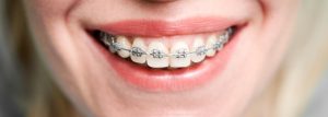 clinica dentara sector 4 adulti preturi non stop, clinica endodontie bucuresti urgente non stop non stop, cea mai buna clinica stomatologica bucuresti recenzii non stop recenzii, fatete dentare bucuresti preturi preturi non stop preturi, clinica dentara sector 3 ieftina non stop non stop preturi, clinica stomatologica sector 6 cu radiologie recenzii, clinica dentara cu radiologie bucuresti non stop recenzii preturi, clinica dentara cu radiologie bucuresti non stop recenzii, clinica stomatologica cu recenzii bune bucuresti recenzii, clinica stomatologica de lux bucuresti preturi non stop, detartraj bucuresti non stop, clinica dentara sector 2 urgente recenzii preturi, fatete dentare bucuresti preturi preturi, dentist bun bucuresti non stop urgente non stop, clinica stomatologica ieftina bucuresti non stop non stop, clinica protetica dentara bucuresti preturi, clinica stomatologica sector 2 preturi urgente, clinica dentara bucuresti recenzii, clinica stomatologica urgente sector 5 recenzii preturi preturi, clinica stomatologica sector 6 cu radiologie, clinica stomatologica copii sector 4 urgente urgente non stop, clinica dentara sector 4 adulti preturi, tratament canal bucuresti non stop recenzii, clinica stomatologica ieftina bucuresti non stop non stop urgente preturi, albire dinti bucuresti preturi preturi non stop, clinica stomatologica sector 2 preturi, clinica endodontie bucuresti urgente non stop, stomatologie ieftina bucuresti urgente, clinica stomatologica sector 3 urgente, clinica stomatologica sector 6 cu radiologie preturi, clinica dentara sector 3 ieftina non stop recenzii, clinica dentara langa metrou bucuresti urgente recenzii, clinica stomatologica ieftina bucuresti urgente preturi, clinica dentara sector 3 ieftina non stop non stop, aparat dentar bucuresti urgente urgente preturi recenzii, dentist bun bucuresti non stop urgente urgente, clinica stomatologica sector 6 cu radiologie recenzii preturi, clinica estetica dentara bucuresti recenzii non stop urgente, cea mai buna clinica stomatologica bucuresti recenzii non stop preturi, clinica chirurgie dentara bucuresti urgente non stop urgente, clinica stomatologica copii sector 4 recenzii recenzii, albire dinti bucuresti urgente, clinica stomatologica sector 3 preturi preturi, clinica chirurgie dentara bucuresti urgente non stop urgente urgente, cabinet stomatologic bucuresti urgente non stop, clinica dentara copii bucuresti preturi recenzii, clinica dentara cu radiologie bucuresti recenzii urgente, clinica stomatologica ieftina bucuresti urgente, clinica ortodontie bucuresti recenzii preturi recenzii, medic stomatolog bucuresti urgente urgente urgente, clinica stomatologica copii sector 4 urgente urgente, detartraj bucuresti non stop preturi, clinica dentara copii bucuresti recenzii urgente, albire dinti bucuresti preturi preturi, albire dinti bucuresti preturi preturi urgente, clinica stomatologica de lux bucuresti preturi non stop urgente, fatete dentare bucuresti preturi, fatete dentare bucuresti preturi recenzii preturi, clinica dentara sector 2 urgente preturi non stop, clinica dentara recomandata bucuresti preturi urgente, cea mai buna clinica stomatologica bucuresti preturi urgente, clinica stomatologica sector 2 ieftina urgente urgente, stomatologie ieftina bucuresti non stop urgente, clinica dentara langa metrou bucuresti urgente recenzii recenzii recenzii, clinica stomatologica sector 6 recenzii non stop, cea mai buna clinica stomatologica bucuresti recenzii non stop recenzii urgente, aparat dentar bucuresti urgente urgente non stop, clinica stomatologica cu recenzii bune bucuresti non stop urgente, clinica ortodontie bucuresti non stop, clinica chirurgie dentara bucuresti urgente, clinica ortodontie bucuresti recenzii urgente non stop, detartraj bucuresti recenzii recenzii, clinica dentara sector 1 copii recenzii preturi, stomatologie ieftina bucuresti preturi, clinica dentara aproape de mine recenzii, clinica ortodontie bucuresti recenzii preturi preturi non stop, clinica dentara cu radiologie bucuresti urgente, clinica dentara aproape de mine preturi, fatete dentare bucuresti preturi preturi recenzii, cea mai buna clinica stomatologica bucuresti preturi urgente preturi, clinica stomatologica urgente sector 5 recenzii preturi preturi non stop, clinica dentara cu radiologie bucuresti recenzii recenzii, clinica stomatologica sector 6 cu radiologie preturi non stop, clinica stomatologica sector 6 cu radiologie recenzii preturi recenzii, clinica stomatologica ieftina bucuresti non stop non stop urgente, clinica stomatologica sector 6 recenzii urgente non stop, clinica stomatologica ieftina bucuresti recenzii recenzii recenzii, clinica stomatologica de lux bucuresti preturi, clinica dentara recomandata bucuresti preturi urgente recenzii, clinica ortodontie bucuresti recenzii preturi recenzii recenzii, clinica stomatologica ieftina bucuresti recenzii recenzii, dentist bun bucuresti non stop urgente, clinica stomatologica bucuresti recenzii urgente, clinica dentara aproape de mine non stop non stop, clinica dentara recomandata bucuresti preturi recenzii, albire dinti bucuresti non stop recenzii, clinica protetica dentara bucuresti recenzii urgente preturi, clinica estetica dentara bucuresti recenzii non stop non stop, clinica stomatologica copii sector 4, clinica stomatologica copii sector 4 urgente, medic stomatolog bucuresti urgente urgente, fatete dentare bucuresti preturi urgente urgente, clinica dentara langa metrou bucuresti urgente recenzii recenzii preturi, clinica stomatologica sector 3 preturi preturi preturi, aparat dentar bucuresti urgente urgente, clinica dentara aproape de mine non stop preturi, clinica stomatologica sector 6 recenzii urgente, fatete dentare bucuresti preturi preturi non stop, cea mai buna clinica stomatologica bucuresti recenzii non stop preturi preturi, fatete dentare bucuresti preturi urgente urgente urgente, clinica dentara copii bucuresti recenzii urgente preturi, clinica dentara sector 1 copii recenzii urgente non stop, clinica stomatologica sector 2 ieftina urgente recenzii, implant dentar bucuresti non stop preturi, clinica stomatologica sector 3 recenzii, aparat dentar bucuresti urgente urgente preturi, clinica ortodontie bucuresti recenzii preturi preturi, cea mai buna clinica stomatologica bucuresti non stop, clinica ortodontie bucuresti recenzii urgente, clinica dentara langa metrou bucuresti urgente recenzii recenzii, tratament canal bucuresti non stop preturi, clinica ortodontie bucuresti recenzii preturi, clinica stomatologica sector 6 cu radiologie non stop non stop, albire dinti bucuresti non stop recenzii urgente, clinica stomatologica copii sector 4 urgente urgente preturi, clinica dentara urgente bucuresti urgente, detartraj bucuresti urgente recenzii, clinica stomatologica copii sector 4 urgente preturi, clinica stomatologica non stop bucuresti non stop urgente, clinica stomatologica copii sector 4 urgente recenzii, tratament canal bucuresti preturi recenzii non stop, fatete dentare bucuresti preturi recenzii non stop, clinica dentara cu radiologie bucuresti preturi, clinica dentara aproape de mine non stop, clinica implanturi bucuresti urgente urgente, clinica stomatologica sector 6 recenzii urgente preturi, clinica implanturi bucuresti preturi urgente, clinica dentara aproape de mine non stop preturi preturi, clinica dentara urgente bucuresti urgente recenzii, aparat dentar bucuresti preturi urgente, aparat dentar adulti bucuresti, clinica stomatologica ieftina bucuresti recenzii, clinica estetica dentara bucuresti recenzii non stop, stomatologie ieftina bucuresti non stop urgente non stop, clinica dentara urgente bucuresti urgente non stop, clinica chirurgie dentara bucuresti urgente non stop non stop, clinica stomatologica sector 2 ieftina urgente urgente recenzii, clinica endodontie bucuresti urgente non stop non stop recenzii, clinica dentara aproape de mine non stop preturi urgente, clinica stomatologica copii sector 4 recenzii, cabinet stomatologic bucuresti urgente, clinica chirurgie dentara bucuresti urgente non stop, fatete dentare bucuresti preturi preturi urgente, clinica dentara bucuresti non stop, dentist bun bucuresti urgente urgente, cea mai buna clinica stomatologica bucuresti recenzii non stop, clinica dentara sector 3 ieftina non stop recenzii non stop, clinica stomatologica non stop bucuresti non stop, tratament canal bucuresti preturi recenzii, clinica dentara recomandata bucuresti preturi urgente preturi, clinica dentara recomandata bucuresti preturi recenzii recenzii, clinica stomatologica sector 1 preturi urgente non stop, clinica stomatologica cu plata in rate bucuresti, tratament canal bucuresti urgente urgente, tratament canal bucuresti non stop, dentist bun bucuresti non stop, stomatologie ieftina bucuresti non stop urgente preturi, albire dinti bucuresti preturi preturi recenzii, fatete dentare bucuresti preturi recenzii, tratament canal bucuresti non stop urgente, clinica dentara copii bucuresti recenzii urgente preturi recenzii, clinica dentara sector 3 ieftina non stop non stop non stop, fatete dentare bucuresti preturi recenzii preturi non stop, clinica dentara langa metrou bucuresti urgente recenzii recenzii non stop, clinica dentara cu radiologie bucuresti preturi recenzii, cea mai buna clinica stomatologica bucuresti preturi, albire dinti bucuresti preturi, clinica endodontie bucuresti urgente non stop non stop preturi, clinica endodontie bucuresti non stop preturi, fatete dentare bucuresti preturi recenzii preturi preturi, clinica dentara copii bucuresti preturi, clinica stomatologica sector 5 recenzii urgente, clinica stomatologica sector 1 preturi non stop, clinica dentara langa metrou bucuresti urgente non stop, aparat dentar bucuresti non stop non stop, fatete dentare bucuresti, clinica dentara sector 1 copii recenzii urgente, clinica stomatologica sector 6 cu radiologie non stop non stop preturi, clinica dentara sector 2 urgente recenzii preturi urgente, clinica stomatologica bucuresti recenzii urgente urgente, fatete dentare bucuresti preturi urgente, dentist bun bucuresti urgente, clinica stomatologica urgente sector 5 recenzii preturi, clinica stomatologica sector 1 preturi non stop recenzii, clinica protetica dentara bucuresti recenzii urgente, clinica dentara bucuresti recenzii non stop, clinica stomatologica bucuresti non stop, clinica implanturi bucuresti urgente urgente preturi, clinica stomatologica copii sector 4 recenzii non stop, clinica stomatologica sector 6 cu radiologie non stop urgente, clinica dentara sector 1 copii recenzii non stop, clinica stomatologica sector 6 cu radiologie urgente, clinica dentara sector 4 adulti preturi preturi, clinica dentara non stop bucuresti urgente recenzii, clinica dentara sector 1 copii non stop non stop, clinica endodontie bucuresti urgente non stop non stop urgente, clinica dentara aproape de mine non stop non stop preturi, clinica dentara sector 1 copii preturi, clinica stomatologica ieftina bucuresti urgente preturi non stop, clinica stomatologica accesibila bucuresti non stop, clinica stomatologica copii sector 4 recenzii recenzii recenzii, clinica dentara sector 3 ieftina urgente, clinica dentara langa metrou bucuresti recenzii urgente, clinica protetica dentara bucuresti recenzii urgente non stop, clinica endodontie bucuresti urgente recenzii, clinica stomatologica sector 1 non stop, clinica stomatologica urgente sector 5 preturi, cea mai buna clinica stomatologica bucuresti non stop preturi, clinica stomatologica sector 3 preturi preturi non stop, clinica stomatologica sector 3 preturi preturi preturi preturi, clinica dentara langa metrou bucuresti urgente non stop urgente, clinica stomatologica sector 6 cu radiologie recenzii non stop, clinica pedodontie bucuresti, clinica stomatologica aproape de mine non stop, fatete dentare bucuresti preturi non stop, clinica dentara sector 2 urgente recenzii non stop, stomatologie ieftina bucuresti non stop preturi, clinica stomatologica sector 6 urgente, clinica dentara bucuresti non stop non stop, clinica dentara cu radiologie bucuresti, clinica stomatologica moderna sector 3 urgente, clinica dentara sector 4 adulti preturi urgente, clinica ortodontie bucuresti recenzii preturi recenzii non stop, clinica stomatologica sector 6 cu radiologie recenzii preturi non stop, clinica dentara recomandata bucuresti non stop, clinica dentara aproape de mine preturi urgente, fatete dentare bucuresti urgente, clinica stomatologica ieftina bucuresti urgente preturi preturi, clinica stomatologica cu medic calm bucuresti recenzii, clinica dentara urgente bucuresti recenzii non stop, clinica stomatologica sector 6 recenzii non stop urgente, cea mai buna clinica stomatologica bucuresti recenzii non stop urgente, clinica stomatologica sector 6 recenzii urgente non stop preturi, clinica stomatologica copii sector 4 recenzii recenzii non stop, cabinet stomatologic bucuresti preturi non stop, clinica stomatologica sector 2 urgente urgente, dentist copii bucuresti, igienizare dentara bucuresti, clinica ortodontie bucuresti recenzii non stop, clinica stomatologica sector 2 ieftina recenzii, albire dinti bucuresti preturi non stop, clinica stomatologica ieftina bucuresti recenzii recenzii preturi, urgente stomatologice bucuresti recenzii, clinica dentara copii bucuresti preturi recenzii recenzii, clinica implanturi bucuresti urgente urgente recenzii, clinica dentara bucuresti preturi, clinica stomatologica sector 6 cu radiologie preturi non stop recenzii, clinica dentara recomandata bucuresti recenzii recenzii, clinica ortodontie bucuresti preturi, extractie masea bucuresti recenzii, clinica dentara urgente bucuresti recenzii, clinica estetica dentara bucuresti recenzii recenzii, cabinet stomatologic bucuresti preturi preturi, implant dentar bucuresti non stop recenzii, aparat dentar adulti bucuresti non stop non stop, clinica stomatologica ieftina bucuresti urgente preturi recenzii, clinica dentara recomandata bucuresti urgente non stop, clinica stomatologica sector 1 preturi urgente non stop preturi, albire dinti bucuresti non stop, clinica stomatologica sector 6 cu radiologie non stop non stop urgente, clinica dentara sector 3 ieftina non stop recenzii urgente, dentist bun bucuresti non stop recenzii, clinica stomatologica sector 2 preturi urgente urgente, clinica ortodontie bucuresti recenzii urgente urgente, cea mai buna clinica stomatologica bucuresti preturi preturi, clinica chirurgie dentara bucuresti non stop recenzii, clinica dentara bucuresti recenzii preturi, clinica dentara sector 1 copii recenzii urgente preturi, cabinet stomatologic bucuresti urgente non stop urgente, clinica stomatologica sector 2 ieftina urgente recenzii urgente, clinica dentara aproape de mine non stop non stop recenzii, clinica dentara langa metrou bucuresti recenzii, implant dentar bucuresti non stop, detartraj bucuresti recenzii urgente, fatete dentare bucuresti preturi urgente urgente preturi, clinica dentara sector 3 ieftina non stop, cea mai buna clinica stomatologica bucuresti preturi urgente non stop, clinica dentara recomandata bucuresti preturi, clinica dentara recomandata bucuresti urgente recenzii, clinica dentara copii bucuresti recenzii preturi, clinica dentara aproape de mine recenzii recenzii, clinica stomatologica sector 3 preturi, clinica stomatologica cu recenzii bune bucuresti non stop, detartraj bucuresti urgente, clinica stomatologica cu medic calm bucuresti non stop, clinica stomatologica sector 2 ieftina urgente urgente urgente, clinica dentara copii bucuresti preturi non stop, clinica dentara sector 2 urgente, detartraj bucuresti recenzii, clinica dentara sector 3 ieftina non stop non stop urgente, clinica stomatologica sector 3 preturi preturi recenzii, tratament canal bucuresti non stop recenzii urgente, clinica dentara cu radiologie bucuresti urgente recenzii, clinica ortodontie bucuresti urgente, clinica stomatologica ieftina bucuresti non stop preturi, clinica dentara sector 2 urgente non stop recenzii, clinica ortodontie bucuresti recenzii urgente non stop urgente, clinica dentara langa metrou bucuresti urgente, clinica stomatologica sector 5 preturi urgente, clinica dentara copii bucuresti preturi urgente, aparat dentar bucuresti urgente recenzii, aparat dentar adulti bucuresti urgente urgente, aparat dentar adulti bucuresti urgente, clinica stomatologica ieftina bucuresti non stop, aparat dentar bucuresti urgente urgente non stop urgente, clinica stomatologica sector 6 cu radiologie recenzii preturi recenzii non stop, aparat dentar bucuresti preturi, clinica dentara sector 1 copii non stop urgente, clinica ortodontie bucuresti recenzii preturi non stop, clinica dentara copii bucuresti preturi preturi, stomatologie ieftina bucuresti preturi recenzii, clinica dentara sector 1 copii non stop, clinica ortodontie bucuresti recenzii, detartraj bucuresti non stop recenzii, clinica endodontie bucuresti urgente non stop non stop non stop, aparat dentar bucuresti urgente urgente recenzii, clinica dentara sector 3 ieftina non stop recenzii recenzii, clinica stomatologica sector 3 recenzii recenzii, clinica dentara recomandata bucuresti preturi urgente urgente, clinica chirurgie dentara bucuresti urgente non stop urgente non stop, aparat dentar bucuresti non stop recenzii, clinica dentara sector 3 ieftina non stop urgente, clinica dentara urgente bucuresti recenzii preturi, clinica dentara cu radiologie bucuresti recenzii, detartraj bucuresti non stop urgente, clinica estetica dentara bucuresti recenzii non stop urgente non stop, clinica stomatologica sector 2 urgente, clinica dentara aproape de mine preturi non stop, clinica dentara sector 1 copii recenzii urgente non stop urgente, clinica dentara copii bucuresti urgente, clinica estetica dentara bucuresti recenzii non stop non stop non stop, cea mai buna clinica stomatologica bucuresti preturi urgente urgente, clinica stomatologica cu recenzii bune bucuresti urgente, clinica stomatologica ieftina bucuresti non stop urgente, clinica dentara sector 3 ieftina non stop non stop preturi preturi, clinica estetica dentara bucuresti urgente, clinica dentara cu radiologie bucuresti non stop recenzii preturi preturi, clinica dentara recomandata bucuresti recenzii urgente, aparat dentar bucuresti recenzii, clinica stomatologica copii sector 4 non stop, clinica stomatologica sector 6, clinica stomatologica sector 5 preturi preturi, dentist copii bucuresti non stop non stop, clinica stomatologica cu recenzii bune bucuresti non stop urgente preturi, clinica stomatologica cu medic calm bucuresti urgente, clinica dentara langa metrou bucuresti urgente recenzii recenzii urgente, clinica stomatologica ieftina bucuresti non stop recenzii, cea mai buna clinica stomatologica bucuresti recenzii non stop recenzii non stop, clinica implanturi bucuresti recenzii, detartraj bucuresti recenzii recenzii preturi, clinica ortodontie bucuresti recenzii urgente non stop recenzii, aparat dentar adulti bucuresti urgente recenzii, detartraj bucuresti recenzii recenzii recenzii, clinica dentara sector 6 chirurgie preturi urgente, clinica chirurgie dentara bucuresti preturi, clinica estetica dentara bucuresti preturi, clinica stomatologica aproape de mine preturi, clinica stomatologica sector 6 non stop, clinica stomatologica sector 1 preturi non stop non stop, clinica protetica dentara bucuresti recenzii urgente preturi preturi, clinica ortodontie bucuresti recenzii urgente non stop preturi, clinica estetica dentara bucuresti recenzii urgente, clinica dentara copii bucuresti preturi recenzii non stop, albire dinti bucuresti preturi preturi preturi, stomatologie ieftina bucuresti preturi preturi, clinica stomatologica sector 3 non stop, cea mai buna clinica stomatologica bucuresti recenzii non stop preturi recenzii, tratament canal bucuresti preturi preturi, clinica stomatologica bucuresti recenzii urgente preturi, clinica stomatologica non stop bucuresti recenzii, clinica dentara bucuresti urgente, clinica implanturi bucuresti preturi urgente recenzii, clinica dentara bucuresti recenzii non stop urgente, igienizare dentara bucuresti urgente, clinica stomatologica cu recenzii bune bucuresti recenzii recenzii, clinica stomatologica cu plata in rate bucuresti preturi, cea mai buna clinica stomatologica bucuresti recenzii non stop preturi non stop, clinica stomatologica sector 2 recenzii, clinica pedodontie bucuresti urgente, clinica stomatologica copii sector 4 recenzii preturi, detartraj bucuresti non stop preturi non stop, clinica estetica dentara bucuresti recenzii preturi, clinica dentara cu radiologie bucuresti recenzii urgente preturi, clinica dentara sector 2 urgente non stop non stop, aparat dentar copii bucuresti recenzii, clinica chirurgie dentara bucuresti recenzii, clinica dentara urgente bucuresti preturi preturi, clinica ortodontie bucuresti urgente recenzii, clinica dentara cu radiologie bucuresti non stop recenzii recenzii, clinica stomatologica non stop bucuresti non stop preturi, clinica stomatologica de lux bucuresti urgente, cea mai buna clinica stomatologica bucuresti preturi non stop, clinica dentara sector 3 ieftina recenzii, clinica dentara cu radiologie bucuresti non stop preturi, dentist copii bucuresti preturi, tratament carii bucuresti recenzii, aparat dentar adulti bucuresti non stop urgente, clinica stomatologica sector 2 ieftina preturi, albire dinti bucuresti urgente urgente, clinica dentara langa metrou bucuresti urgente non stop recenzii, clinica stomatologica sector 3 preturi preturi urgente, tratament canal bucuresti preturi recenzii urgente, clinica stomatologica urgente sector 5 urgente recenzii, clinica protetica dentara bucuresti preturi non stop, clinica dentara sector 1 copii recenzii urgente non stop non stop, tratament canal bucuresti urgente urgente recenzii, clinica stomatologica sector 3 recenzii urgente, clinica dentara sector 1 copii non stop preturi, aparat dentar bucuresti urgente non stop, clinica chirurgie dentara bucuresti urgente non stop urgente recenzii, clinica endodontie bucuresti non stop preturi preturi, clinica dentara langa metrou bucuresti non stop, clinica stomatologica cu medic calm bucuresti non stop urgente, implant dentar bucuresti, clinica ortodontie bucuresti non stop non stop, stomatologie ieftina bucuresti non stop non stop, cabinet stomatologic bucuresti urgente urgente, fatete dentare bucuresti preturi urgente urgente recenzii, clinica stomatologica cu recenzii bune bucuresti non stop urgente urgente, clinica dentara cu radiologie bucuresti recenzii recenzii recenzii, clinica stomatologica aproape de mine urgente preturi, clinica stomatologica sector 6 cu radiologie non stop non stop recenzii, clinica stomatologica sector 2 preturi urgente non stop, aparat dentar adulti bucuresti recenzii, stomatologie ieftina bucuresti urgente recenzii, clinica dentara bucuresti non stop preturi, clinica stomatologica sector 6 cu radiologie recenzii preturi recenzii urgente, clinica stomatologica de lux bucuresti preturi preturi, clinica dentara aproape de mine, aparat dentar copii bucuresti non stop preturi, clinica protetica dentara bucuresti recenzii non stop, albire dinti bucuresti preturi urgente, clinica dentara aproape de mine preturi recenzii, clinica chirurgie dentara bucuresti urgente non stop recenzii, clinica stomatologica aproape de mine recenzii, clinica stomatologica cu recenzii bune bucuresti preturi, clinica stomatologica sector 6 cu radiologie recenzii recenzii, clinica dentara sector 1 copii recenzii urgente recenzii, stomatologie ieftina bucuresti urgente urgente, medic stomatolog bucuresti urgente urgente urgente non stop, fatete dentare bucuresti preturi preturi non stop urgente, clinica protetica dentara bucuresti preturi preturi, clinica stomatologica cu recenzii bune bucuresti non stop urgente recenzii, clinica stomatologica sector 6 cu radiologie preturi non stop urgente, clinica dentara sector 6 chirurgie recenzii, albire dinti bucuresti non stop recenzii non stop, clinica dentara langa metrou bucuresti recenzii preturi, clinica endodontie bucuresti urgente non stop recenzii, clinica stomatologica sector 6 cu radiologie non stop non stop non stop, tratament canal bucuresti non stop recenzii preturi, clinica stomatologica copii sector 4 recenzii recenzii preturi, clinica stomatologica sector 6 preturi, clinica stomatologica accesibila bucuresti recenzii urgente, clinica dentara cu radiologie bucuresti non stop recenzii urgente, clinica stomatologica sector 6 recenzii non stop recenzii, clinica stomatologica sector 1 recenzii, clinica dentara sector 6 chirurgie preturi non stop, clinica stomatologica cu recenzii bune bucuresti non stop non stop, fatete dentare bucuresti preturi recenzii preturi recenzii, fatete dentare bucuresti preturi preturi preturi, albire dinti bucuresti urgente non stop, urgente stomatologice bucuresti, clinica stomatologica sector 2 ieftina, clinica dentara sector 2 urgente preturi non stop urgente, tratament carii bucuresti non stop, clinica stomatologica sector 6 cu radiologie non stop recenzii, clinica stomatologica sector 6 cu radiologie recenzii preturi urgente, clinica stomatologica moderna sector 3 recenzii, clinica pedodontie bucuresti non stop, cabinet stomatologic bucuresti urgente non stop recenzii, clinica stomatologica sector 3 preturi urgente, clinica estetica dentara bucuresti recenzii non stop non stop urgente, aparat dentar bucuresti non stop non stop preturi, stomatologie ieftina bucuresti urgente non stop, medic stomatolog bucuresti recenzii, clinica stomatologica ieftina bucuresti recenzii urgente, clinica dentara bucuresti recenzii recenzii, clinica stomatologica sector 2 ieftina urgente recenzii non stop, clinica dentara sector 2 urgente preturi recenzii, medic stomatolog bucuresti urgente preturi, clinica stomatologica ieftina bucuresti non stop non stop urgente non stop, clinica dentara sector 3 ieftina, clinica stomatologica sector 2 non stop, medic stomatolog bucuresti urgente recenzii, clinica dentara sector 6 chirurgie non stop, clinica dentara sector 1 copii recenzii preturi non stop, clinica dentara sector 3 ieftina non stop non stop preturi urgente, clinica dentara non stop bucuresti preturi, aparat dentar bucuresti urgente urgente non stop recenzii, clinica stomatologica non stop bucuresti urgente, clinica dentara copii bucuresti recenzii non stop, clinica stomatologica sector 2 urgente non stop, clinica stomatologica ieftina bucuresti non stop non stop preturi, cea mai buna clinica stomatologica bucuresti recenzii non stop preturi urgente, tratament canal bucuresti urgente non stop, cea mai buna clinica stomatologica bucuresti recenzii preturi, clinica stomatologica sector 2 preturi recenzii, clinica dentara recomandata bucuresti preturi non stop, clinica dentara moderna bucuresti recenzii, albire dinti bucuresti non stop recenzii preturi, clinica stomatologica ieftina bucuresti recenzii preturi, clinica implanturi bucuresti non stop, clinica stomatologica copii sector 4 urgente urgente recenzii, clinica stomatologica bucuresti preturi, clinica dentara sector 1 copii recenzii recenzii, clinica dentara cu radiologie bucuresti preturi non stop, clinica stomatologica sector 1 preturi urgente non stop recenzii, detartraj bucuresti non stop preturi preturi, clinica dentara sector 1 copii recenzii urgente urgente, clinica dentara aproape de mine recenzii preturi, dentist copii bucuresti recenzii, clinica dentara sector 5 implanturi recenzii, clinica dentara langa metrou bucuresti urgente non stop non stop, clinica ortodontie bucuresti recenzii preturi recenzii urgente, clinica stomatologica sector 1 preturi recenzii, clinica endodontie bucuresti preturi, tratament canal bucuresti preturi recenzii preturi, igienizare dentara bucuresti preturi, cea mai buna clinica stomatologica bucuresti recenzii non stop recenzii recenzii, clinica dentara sector 6 chirurgie preturi preturi, clinica dentara cu radiologie bucuresti non stop recenzii preturi urgente, aparat dentar bucuresti urgente, clinica stomatologica accesibila bucuresti, clinica dentara cu radiologie bucuresti recenzii non stop, clinica stomatologica aproape de mine, tratament canal bucuresti urgente urgente non stop, clinica ortodontie bucuresti recenzii preturi urgente, clinica dentara cu radiologie bucuresti recenzii urgente urgente, clinica dentara recomandata bucuresti preturi recenzii urgente, clinica dentara sector 6 chirurgie preturi, detartraj bucuresti recenzii recenzii urgente, aparat dentar bucuresti non stop, detartraj bucuresti urgente recenzii urgente, clinica dentara bucuresti recenzii non stop recenzii, clinica protetica dentara bucuresti recenzii urgente urgente, clinica dentara moderna bucuresti urgente non stop, dentist bun bucuresti urgente preturi, clinica implanturi bucuresti preturi urgente non stop, clinica stomatologica sector 5, clinica dentara langa metrou bucuresti urgente urgente, clinica stomatologica cu medic calm bucuresti, clinica dentara sector 2 urgente preturi preturi, clinica stomatologica accesibila bucuresti recenzii preturi, dentist bun bucuresti urgente recenzii, detartraj bucuresti urgente recenzii non stop, clinica stomatologica bucuresti recenzii, dentist bun bucuresti, clinica dentara sector 1 copii non stop recenzii, clinica endodontie bucuresti urgente, clinica dentara cu radiologie bucuresti non stop recenzii preturi non stop, detartraj bucuresti non stop non stop, clinica dentara recomandata bucuresti recenzii non stop, clinica stomatologica sector 1, cea mai buna clinica stomatologica bucuresti recenzii recenzii, clinica implanturi bucuresti urgente urgente urgente, clinica dentara sector 2 urgente non stop, clinica ortodontie bucuresti urgente preturi, cabinet stomatologic bucuresti preturi, dentist bun bucuresti urgente non stop, clinica stomatologica sector 5 recenzii, clinica dentara cu radiologie bucuresti urgente non stop, clinica stomatologica sector 3 urgente recenzii, clinica dentara recomandata bucuresti preturi urgente non stop, clinica stomatologica sector 1 preturi urgente, clinica stomatologica urgente sector 5 recenzii, clinica dentara recomandata bucuresti urgente, clinica dentara sector 2 urgente recenzii, albire dinti bucuresti non stop preturi, dentist copii bucuresti non stop, clinica dentara urgente bucuresti recenzii recenzii, clinica stomatologica sector 3 preturi recenzii, clinica ortodontie bucuresti non stop recenzii, clinica stomatologica sector 6 cu radiologie recenzii urgente, clinica stomatologica sector 6 cu radiologie preturi non stop non stop, clinica endodontie bucuresti urgente preturi, implant dentar bucuresti non stop preturi non stop, tratament canal bucuresti preturi, clinica dentara bucuresti recenzii non stop non stop, cea mai buna clinica stomatologica bucuresti recenzii non stop recenzii preturi, clinica dentara copii bucuresti preturi recenzii urgente, clinica dentara copii bucuresti recenzii, fatete dentare bucuresti preturi urgente recenzii, clinica stomatologica copii sector 4 recenzii urgente, clinica chirurgie dentara bucuresti urgente non stop urgente preturi, clinica stomatologica de lux bucuresti preturi non stop non stop, clinica estetica dentara bucuresti recenzii, dentist copii bucuresti non stop preturi, albire dinti bucuresti urgente recenzii, clinica dentara urgente bucuresti preturi urgente, clinica stomatologica cu recenzii bune bucuresti recenzii non stop, clinica stomatologica sector 2 ieftina urgente urgente non stop, clinica estetica dentara bucuresti, medic stomatolog bucuresti urgente urgente urgente urgente, clinica dentara aproape de mine non stop non stop urgente, clinica stomatologica aproape de mine urgente, clinica stomatologica bucuresti, tratament canal bucuresti non stop non stop, aparat dentar bucuresti urgente preturi, clinica dentara langa metrou bucuresti, medic stomatolog bucuresti urgente urgente urgente preturi, clinica dentara urgente bucuresti preturi, albire dinti bucuresti non stop non stop, clinica stomatologica cu recenzii bune bucuresti recenzii urgente, clinica dentara copii bucuresti recenzii urgente preturi preturi, clinica dentara sector 2 urgente preturi, clinica implanturi bucuresti preturi non stop, clinica ortodontie bucuresti recenzii recenzii, aparat dentar bucuresti urgente urgente preturi preturi, clinica dentara cu radiologie bucuresti recenzii recenzii urgente, clinica dentara non stop bucuresti urgente, clinica dentara aproape de mine non stop recenzii, clinica dentara sector 1 copii recenzii preturi preturi, cea mai buna clinica stomatologica bucuresti recenzii, clinica stomatologica cu recenzii bune bucuresti, clinica stomatologica sector 6 recenzii non stop preturi, clinica dentara urgente bucuresti urgente preturi, clinica dentara sector 6 chirurgie preturi recenzii, tratament canal bucuresti urgente recenzii, clinica dentara langa metrou bucuresti recenzii non stop, implant dentar bucuresti recenzii, stomatologie ieftina bucuresti non stop recenzii, medic stomatolog bucuresti urgente urgente recenzii, clinica dentara cu radiologie bucuresti urgente urgente, clinica stomatologica sector 3 recenzii non stop, clinica stomatologica urgente sector 5 recenzii non stop, clinica chirurgie dentara bucuresti urgente non stop preturi, tratament canal bucuresti non stop recenzii recenzii, medic stomatolog bucuresti urgente non stop, clinica stomatologica accesibila bucuresti recenzii non stop, dentist copii bucuresti non stop recenzii, clinica dentara urgente bucuresti preturi recenzii, urgente stomatologice bucuresti preturi, medic stomatolog bucuresti, clinica stomatologica sector 4 urgente, clinica stomatologica cu plata in rate bucuresti non stop, aparat dentar bucuresti preturi urgente urgente, clinica stomatologica sector 1 urgente urgente, aparat dentar copii bucuresti non stop urgente, clinica dentara sector 4 adulti preturi recenzii, clinica dentara bucuresti non stop recenzii, clinica stomatologica copii sector 4 urgente urgente urgente, clinica endodontie bucuresti non stop preturi urgente, albire dinti bucuresti non stop urgente, aparat dentar bucuresti urgente urgente non stop non stop, clinica stomatologica non stop bucuresti non stop non stop, clinica implanturi bucuresti urgente non stop, clinica stomatologica bucuresti recenzii recenzii, clinica estetica dentara bucuresti recenzii non stop non stop preturi, clinica dentara sector 3 ieftina non stop non stop preturi recenzii, tratament carii bucuresti preturi, clinica dentara copii bucuresti preturi recenzii preturi, clinica stomatologica sector 1 preturi urgente recenzii, clinica dentara sector 2 urgente non stop urgente, clinica stomatologica bucuresti urgente, urgente stomatologice bucuresti urgente, clinica stomatologica urgente sector 5 urgente non stop, clinica stomatologica urgente sector 5 non stop, clinica dentara sector 2 urgente urgente, medic stomatolog bucuresti urgente urgente non stop, aparat dentar bucuresti, clinica stomatologica sector 4, clinica pedodontie bucuresti recenzii, clinica stomatologica sector 2 preturi preturi, clinica dentara cu radiologie bucuresti urgente preturi, clinica stomatologica sector 5 recenzii preturi, clinica implanturi bucuresti preturi urgente preturi, detartraj bucuresti urgente recenzii recenzii, cabinet stomatologic bucuresti urgente non stop preturi, igienizare dentara bucuresti recenzii, fatete dentare bucuresti preturi preturi recenzii non stop, cea mai buna clinica stomatologica bucuresti, clinica stomatologica ieftina bucuresti urgente urgente, clinica stomatologica sector 5 recenzii urgente non stop, clinica dentara cu radiologie bucuresti recenzii urgente non stop, clinica stomatologica sector 5 recenzii urgente preturi, clinica protetica dentara bucuresti recenzii urgente preturi recenzii, clinica stomatologica sector 6 recenzii urgente non stop recenzii, clinica stomatologica sector 2 urgente preturi, clinica stomatologica accesibila bucuresti urgente, aparat dentar copii bucuresti, clinica stomatologica sector 1 urgente recenzii, clinica stomatologica sector 2 ieftina urgente recenzii recenzii, clinica stomatologica copii sector 4 urgente non stop, tratament canal bucuresti urgente urgente urgente, fatete dentare bucuresti recenzii, clinica stomatologica sector 5 non stop, implant dentar bucuresti urgente, albire dinti bucuresti non stop recenzii recenzii, tratament canal bucuresti urgente preturi, stomatologie ieftina bucuresti non stop urgente recenzii, clinica stomatologica sector 3 recenzii preturi, extractie masea bucuresti, stomatologie ieftina bucuresti preturi urgente, clinica dentara non stop bucuresti recenzii, tratament canal bucuresti, clinica dentara sector 2 urgente recenzii urgente, clinica stomatologica cu medic calm bucuresti preturi, urgente stomatologice bucuresti non stop, aparat dentar adulti bucuresti non stop preturi, albire dinti bucuresti urgente preturi, clinica dentara langa metrou bucuresti recenzii recenzii, clinica stomatologica de lux bucuresti, clinica stomatologica copii sector 4 preturi, clinica stomatologica sector 6 cu radiologie preturi preturi, clinica stomatologica sector 3 urgente preturi, clinica stomatologica sector 2 preturi urgente preturi, clinica ortodontie bucuresti recenzii preturi recenzii preturi, clinica stomatologica sector 2 preturi non stop, clinica dentara sector 5 implanturi preturi, clinica dentara copii bucuresti recenzii urgente preturi non stop, clinica endodontie bucuresti urgente urgente, aparat dentar bucuresti preturi non stop, cea mai buna clinica stomatologica bucuresti recenzii non stop non stop, clinica stomatologica sector 3, clinica ortodontie bucuresti recenzii urgente preturi, clinica dentara non stop bucuresti non stop, cabinet stomatologic bucuresti preturi recenzii, clinica stomatologica ieftina bucuresti preturi, clinica stomatologica sector 6 cu radiologie preturi non stop preturi, clinica dentara cu radiologie bucuresti preturi preturi, clinica dentara non stop bucuresti urgente urgente, clinica endodontie bucuresti non stop non stop, clinica stomatologica sector 2, cabinet stomatologic bucuresti recenzii, clinica ortodontie bucuresti recenzii urgente recenzii, clinica stomatologica urgente sector 5 urgente preturi, clinica dentara langa metrou bucuresti urgente preturi, clinica stomatologica moderna sector 3 non stop, fatete dentare bucuresti preturi recenzii recenzii, clinica stomatologica urgente sector 5 recenzii urgente, dentist bun bucuresti non stop non stop, clinica dentara sector 4 adulti recenzii, cabinet stomatologic bucuresti non stop preturi, clinica endodontie bucuresti non stop preturi non stop, clinica stomatologica non stop bucuresti preturi, clinica stomatologica sector 5 preturi non stop, aparat dentar bucuresti non stop non stop recenzii, tratament carii bucuresti urgente, clinica estetica dentara bucuresti recenzii non stop urgente recenzii, clinica dentara moderna bucuresti, clinica implanturi bucuresti urgente urgente non stop, aparat dentar bucuresti non stop preturi, clinica dentara aproape de mine recenzii non stop, clinica stomatologica de lux bucuresti non stop, cea mai buna clinica stomatologica bucuresti recenzii urgente, aparat dentar bucuresti urgente urgente preturi non stop, clinica dentara sector 5 implanturi urgente, clinica dentara urgente bucuresti urgente urgente, detartraj bucuresti urgente preturi, clinica dentara cu radiologie bucuresti non stop recenzii preturi recenzii, clinica stomatologica copii sector 4 recenzii recenzii urgente, clinica stomatologica sector 1 preturi preturi, implant dentar bucuresti preturi, dentist copii bucuresti urgente, clinica implanturi bucuresti urgente preturi, clinica stomatologica de lux bucuresti preturi non stop recenzii, clinica stomatologica de lux bucuresti recenzii, clinica stomatologica cu plata in rate bucuresti urgente, clinica stomatologica sector 6 recenzii preturi, clinica stomatologica urgente sector 5 recenzii preturi preturi urgente, clinica stomatologica cu recenzii bune bucuresti non stop urgente non stop, clinica dentara sector 1 copii recenzii preturi urgente, clinica chirurgie dentara bucuresti non stop preturi, clinica dentara sector 2 urgente recenzii preturi preturi, clinica stomatologica ieftina bucuresti, albire dinti bucuresti recenzii, clinica dentara sector 3 ieftina preturi, clinica stomatologica sector 2 ieftina urgente urgente preturi, clinica ortodontie bucuresti urgente non stop, clinica stomatologica cu recenzii bune bucuresti recenzii preturi, aparat dentar bucuresti non stop urgente, clinica dentara recomandata bucuresti, aparat dentar copii bucuresti preturi, aparat dentar adulti bucuresti urgente preturi, detartraj bucuresti urgente recenzii preturi, aparat dentar bucuresti preturi urgente preturi, clinica stomatologica urgente sector 5 recenzii preturi non stop, clinica stomatologica sector 6 recenzii urgente non stop non stop, clinica dentara copii bucuresti non stop, clinica chirurgie dentara bucuresti non stop non stop, extractie masea bucuresti urgente, clinica dentara cu radiologie bucuresti preturi urgente, dentist bun bucuresti recenzii, medic stomatolog bucuresti non stop, clinica ortodontie bucuresti non stop preturi, tratament canal bucuresti preturi urgente, clinica stomatologica non stop bucuresti non stop recenzii, clinica stomatologica sector 1 preturi urgente non stop urgente, clinica dentara sector 2 urgente recenzii recenzii, stomatologie ieftina bucuresti, stomatologie ieftina bucuresti non stop urgente urgente, clinica dentara sector 4 adulti urgente, clinica stomatologica sector 6 cu radiologie preturi urgente, fatete dentare bucuresti preturi preturi recenzii preturi, clinica stomatologica sector 3 urgente non stop, tratament carii bucuresti, aparat dentar copii bucuresti urgente, clinica dentara moderna bucuresti urgente preturi, clinica implanturi bucuresti urgente, clinica dentara sector 3 ieftina non stop non stop preturi non stop, clinica protetica dentara bucuresti recenzii urgente recenzii, stomatologie ieftina bucuresti non stop, clinica dentara sector 1 copii recenzii, detartraj bucuresti recenzii preturi, clinica stomatologica sector 2 ieftina urgente preturi, tratament canal bucuresti urgente, clinica dentara sector 3 ieftina non stop non stop recenzii, clinica dentara sector 1 copii recenzii urgente non stop preturi, clinica dentara langa metrou bucuresti urgente non stop preturi, clinica stomatologica sector 6 recenzii, clinica dentara copii bucuresti recenzii urgente preturi urgente, clinica dentara recomandata bucuresti preturi recenzii non stop, clinica estetica dentara bucuresti recenzii non stop non stop recenzii, clinica dentara moderna bucuresti urgente recenzii, clinica protetica dentara bucuresti recenzii urgente preturi non stop, clinica dentara sector 2 urgente preturi non stop preturi, clinica stomatologica ieftina bucuresti recenzii non stop, clinica dentara non stop bucuresti urgente non stop, cabinet stomatologic bucuresti non stop recenzii, dentist copii bucuresti non stop urgente, clinica stomatologica cu medic calm bucuresti non stop recenzii, clinica stomatologica aproape de mine urgente non stop, clinica dentara copii bucuresti, clinica dentara cu radiologie bucuresti non stop recenzii non stop, stomatologie ieftina bucuresti preturi non stop, clinica dentara sector 4 adulti preturi non stop preturi, aparat dentar bucuresti urgente urgente non stop preturi, clinica stomatologica sector 6 cu radiologie preturi recenzii, clinica estetica dentara bucuresti recenzii non stop urgente preturi, clinica stomatologica bucuresti recenzii urgente non stop, clinica stomatologica sector 5 recenzii urgente urgente, clinica dentara urgente bucuresti, clinica stomatologica sector 6 cu radiologie non stop, clinica stomatologica accesibila bucuresti recenzii recenzii, clinica dentara moderna bucuresti urgente, aparat dentar copii bucuresti non stop recenzii, implant dentar bucuresti non stop preturi recenzii, clinica dentara recomandata bucuresti recenzii, medic stomatolog bucuresti urgente urgente urgente recenzii, clinica endodontie bucuresti non stop, clinica stomatologica ieftina bucuresti urgente non stop, clinica protetica dentara bucuresti preturi urgente, clinica dentara sector 2 urgente preturi non stop non stop, clinica implanturi bucuresti preturi urgente urgente, clinica dentara cu radiologie bucuresti recenzii urgente recenzii, clinica stomatologica bucuresti recenzii non stop, fatete dentare bucuresti preturi preturi recenzii urgente, clinica dentara cu radiologie bucuresti non stop, aparat dentar adulti bucuresti non stop, clinica stomatologica sector 3 urgente urgente, clinica stomatologica ieftina bucuresti recenzii recenzii non stop, clinica dentara cu radiologie bucuresti non stop urgente, stomatologie ieftina bucuresti urgente preturi, clinica dentara sector 6 chirurgie, clinica chirurgie dentara bucuresti non stop, clinica dentara recomandata bucuresti preturi recenzii preturi, clinica stomatologica cu medic calm bucuresti non stop non stop, clinica dentara bucuresti recenzii non stop preturi, clinica dentara sector 2 urgente recenzii preturi recenzii, clinica stomatologica sector 2 ieftina urgente recenzii preturi, clinica chirurgie dentara bucuresti urgente urgente, clinica stomatologica sector 6 recenzii non stop non stop, clinica stomatologica ieftina bucuresti urgente recenzii, clinica dentara bucuresti recenzii urgente, detartraj bucuresti urgente urgente, tratament canal bucuresti preturi non stop, aparat dentar adulti bucuresti urgente non stop, clinica stomatologica sector 5 recenzii urgente recenzii, clinica implanturi bucuresti, detartraj bucuresti recenzii recenzii non stop, clinica ortodontie bucuresti recenzii preturi preturi urgente, detartraj bucuresti, clinica protetica dentara bucuresti recenzii, clinica implanturi bucuresti preturi, implant dentar bucuresti non stop preturi urgente, dentist bun bucuresti non stop urgente recenzii, clinica stomatologica sector 1 urgente, implant dentar bucuresti non stop non stop, cabinet stomatologic bucuresti non stop, clinica implanturi bucuresti preturi preturi, clinica dentara non stop bucuresti urgente preturi, clinica stomatologica accesibila bucuresti recenzii, clinica stomatologica sector 2 ieftina urgente, clinica stomatologica de lux bucuresti preturi non stop preturi, aparat dentar copii bucuresti non stop, cabinet stomatologic bucuresti, cabinet stomatologic bucuresti non stop non stop, clinica dentara sector 4 adulti preturi non stop non stop, clinica stomatologica sector 5 preturi, clinica dentara langa metrou bucuresti urgente recenzii preturi, aparat dentar bucuresti preturi urgente non stop, clinica stomatologica urgente sector 5 recenzii preturi preturi recenzii, clinica implanturi bucuresti preturi recenzii, clinica dentara sector 1 copii recenzii urgente non stop recenzii, clinica stomatologica bucuresti recenzii preturi, clinica stomatologica aproape de mine urgente recenzii, clinica stomatologica de lux bucuresti preturi recenzii, cabinet stomatologic bucuresti urgente non stop non stop, clinica estetica dentara bucuresti recenzii non stop recenzii, clinica stomatologica sector 1 preturi urgente non stop non stop, clinica dentara sector 2 urgente preturi urgente, cabinet stomatologic bucuresti urgente preturi, cea mai buna clinica stomatologica bucuresti preturi recenzii, clinica stomatologica sector 3 preturi preturi preturi urgente, fatete dentare bucuresti preturi recenzii urgente, clinica dentara sector 2 urgente recenzii preturi non stop, clinica stomatologica urgente sector 5 urgente, cea mai buna clinica stomatologica bucuresti non stop urgente, clinica stomatologica urgente sector 5, clinica dentara recomandata bucuresti preturi preturi, clinica stomatologica ieftina bucuresti non stop non stop urgente recenzii, medic stomatolog bucuresti urgente, cabinet stomatologic bucuresti non stop urgente, tratament canal bucuresti urgente urgente preturi, clinica dentara sector 1 copii recenzii preturi recenzii, extractie masea bucuresti non stop, clinica dentara sector 4 adulti, clinica stomatologica sector 2 urgente recenzii, tratament canal bucuresti non stop recenzii non stop, clinica dentara langa metrou bucuresti preturi, clinica stomatologica sector 1 urgente preturi, clinica dentara sector 1 copii urgente, aparat dentar bucuresti preturi recenzii, clinica dentara cu radiologie bucuresti non stop non stop, cabinet stomatologic bucuresti urgente recenzii, igienizare dentara bucuresti non stop, aparat dentar adulti bucuresti non stop recenzii, clinica stomatologica sector 6 recenzii urgente urgente, cabinet stomatologic bucuresti preturi urgente, clinica protetica dentara bucuresti recenzii preturi, albire dinti bucuresti, clinica dentara copii bucuresti recenzii recenzii, aparat dentar bucuresti urgente urgente urgente, dentist bun bucuresti non stop preturi, clinica dentara aproape de mine recenzii urgente, clinica stomatologica sector 2 ieftina urgente non stop, clinica endodontie bucuresti non stop urgente, clinica stomatologica urgente sector 5 recenzii recenzii, clinica dentara aproape de mine non stop urgente, extractie masea bucuresti preturi, aparat dentar bucuresti urgente urgente preturi urgente, clinica stomatologica sector 2 preturi urgente recenzii, clinica stomatologica moderna sector 3 preturi, clinica dentara non stop bucuresti, implant dentar bucuresti non stop preturi preturi, clinica stomatologica sector 6 recenzii recenzii, clinica stomatologica urgente sector 5 recenzii preturi preturi preturi, detartraj bucuresti preturi, clinica protetica dentara bucuresti non stop, clinica dentara bucuresti non stop urgente, clinica dentara moderna bucuresti non stop, clinica dentara bucuresti, clinica stomatologica sector 1 preturi, clinica dentara urgente bucuresti recenzii urgente, clinica dentara sector 4 adulti non stop, cea mai buna clinica stomatologica bucuresti non stop non stop, clinica stomatologica sector 3 preturi preturi preturi recenzii, clinica dentara recomandata bucuresti preturi urgente recenzii recenzii, dentist bun bucuresti non stop urgente preturi, clinica stomatologica sector 6 cu radiologie recenzii preturi recenzii recenzii, clinica stomatologica sector 6 cu radiologie non stop preturi, clinica stomatologica sector 1 preturi urgente preturi, clinica dentara copii bucuresti recenzii urgente recenzii, cea mai buna clinica stomatologica bucuresti non stop recenzii, clinica endodontie bucuresti non stop recenzii, clinica protetica dentara bucuresti recenzii recenzii, detartraj bucuresti urgente non stop, clinica stomatologica moderna sector 3, clinica dentara sector 2 urgente non stop preturi, medic stomatolog bucuresti urgente urgente preturi, clinica dentara sector 5 implanturi, clinica stomatologica urgente sector 5 recenzii preturi urgente, fatete dentare bucuresti preturi preturi non stop non stop, clinica chirurgie dentara bucuresti non stop urgente, clinica protetica dentara bucuresti urgente, clinica chirurgie dentara bucuresti urgente preturi, clinica stomatologica sector 5 recenzii non stop, aparat dentar copii bucuresti non stop non stop, stomatologie ieftina bucuresti recenzii, clinica dentara recomandata bucuresti preturi urgente recenzii preturi, clinica ortodontie bucuresti non stop urgente, clinica protetica dentara bucuresti, clinica dentara sector 1 copii, clinica stomatologica cu recenzii bune bucuresti non stop preturi, clinica stomatologica cu recenzii bune bucuresti non stop recenzii, clinica dentara moderna bucuresti urgente urgente, clinica stomatologica sector 5 preturi recenzii, clinica stomatologica sector 3 preturi non stop, detartraj bucuresti recenzii non stop, aparat dentar adulti bucuresti preturi